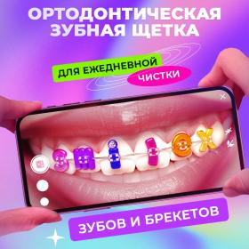 Splat Ортодонтическая мягкая зубная щетка Smilex Ortho. фото