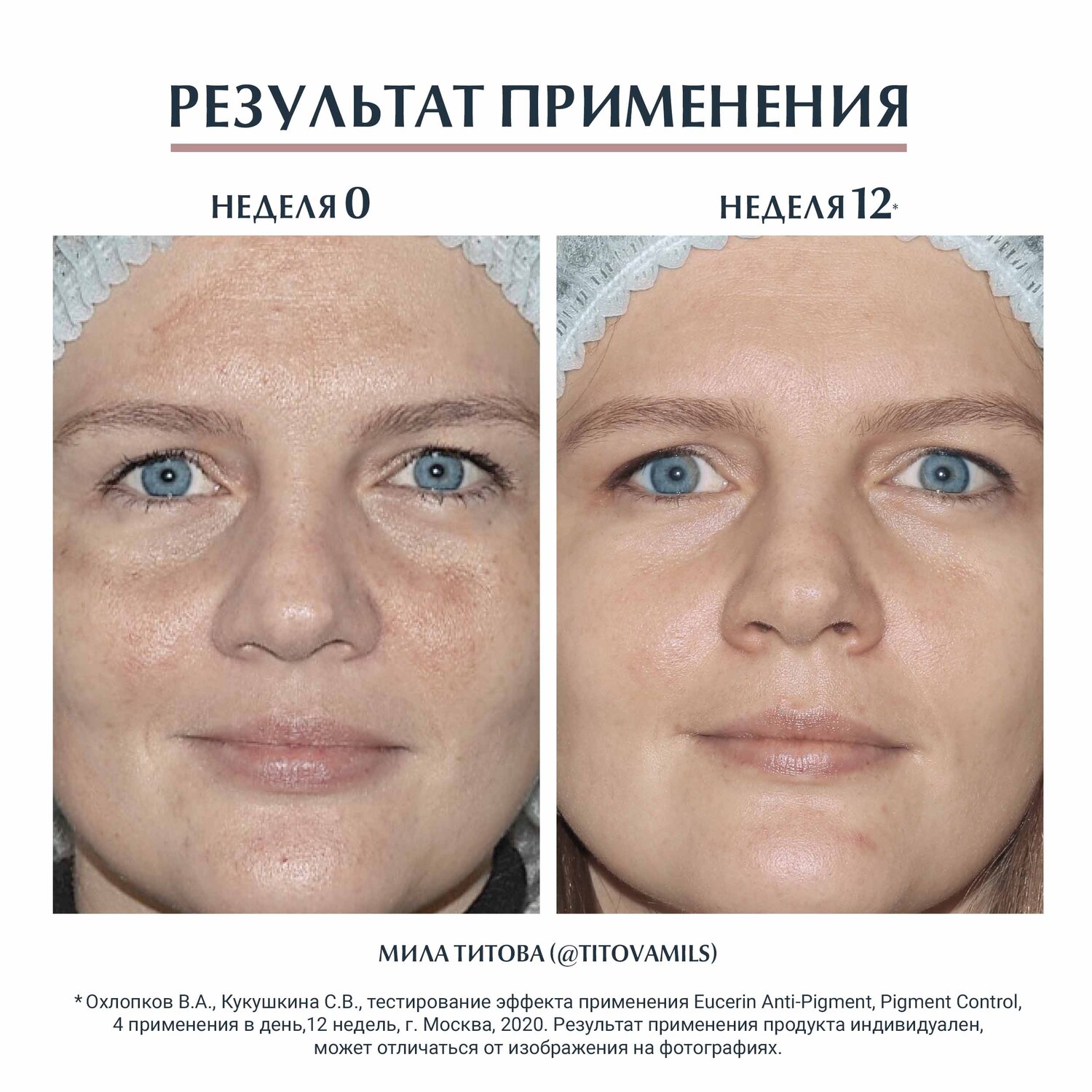 Эуцерин Двойная сыворотка против пигментации, 30 мл (Eucerin, Anti-Pigment) Эуцерин Двойная сыворотка против пигментации, 30 мл (Eucerin, Anti-Pigment) фото 2