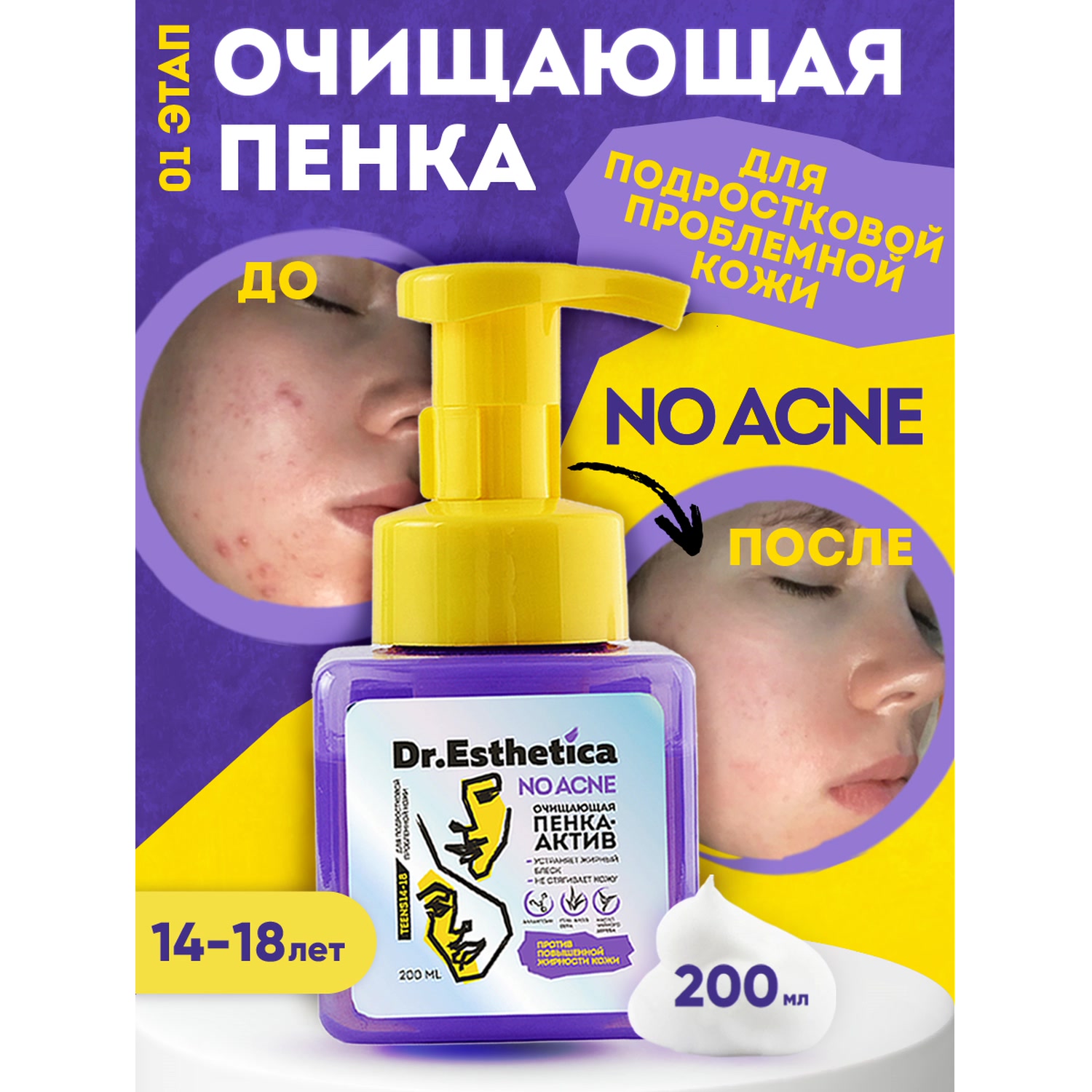 Доктор Эстетик Очищающая пенка-актив, 200 мл (Dr. Esthetica, Teens) фото 4