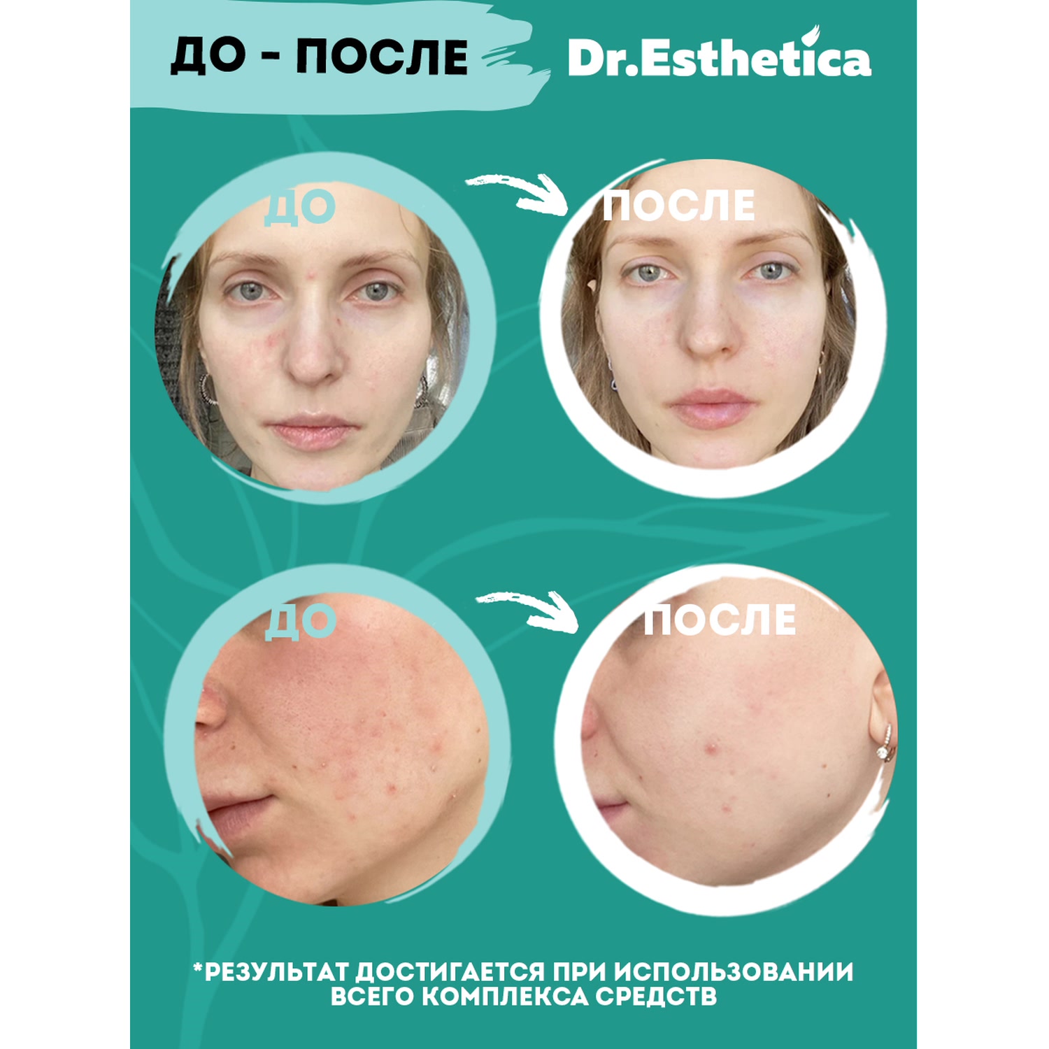 Доктор Эстетик Очищающая пенка-баланс, 200 мл (Dr. Esthetica, Adults) фото 6