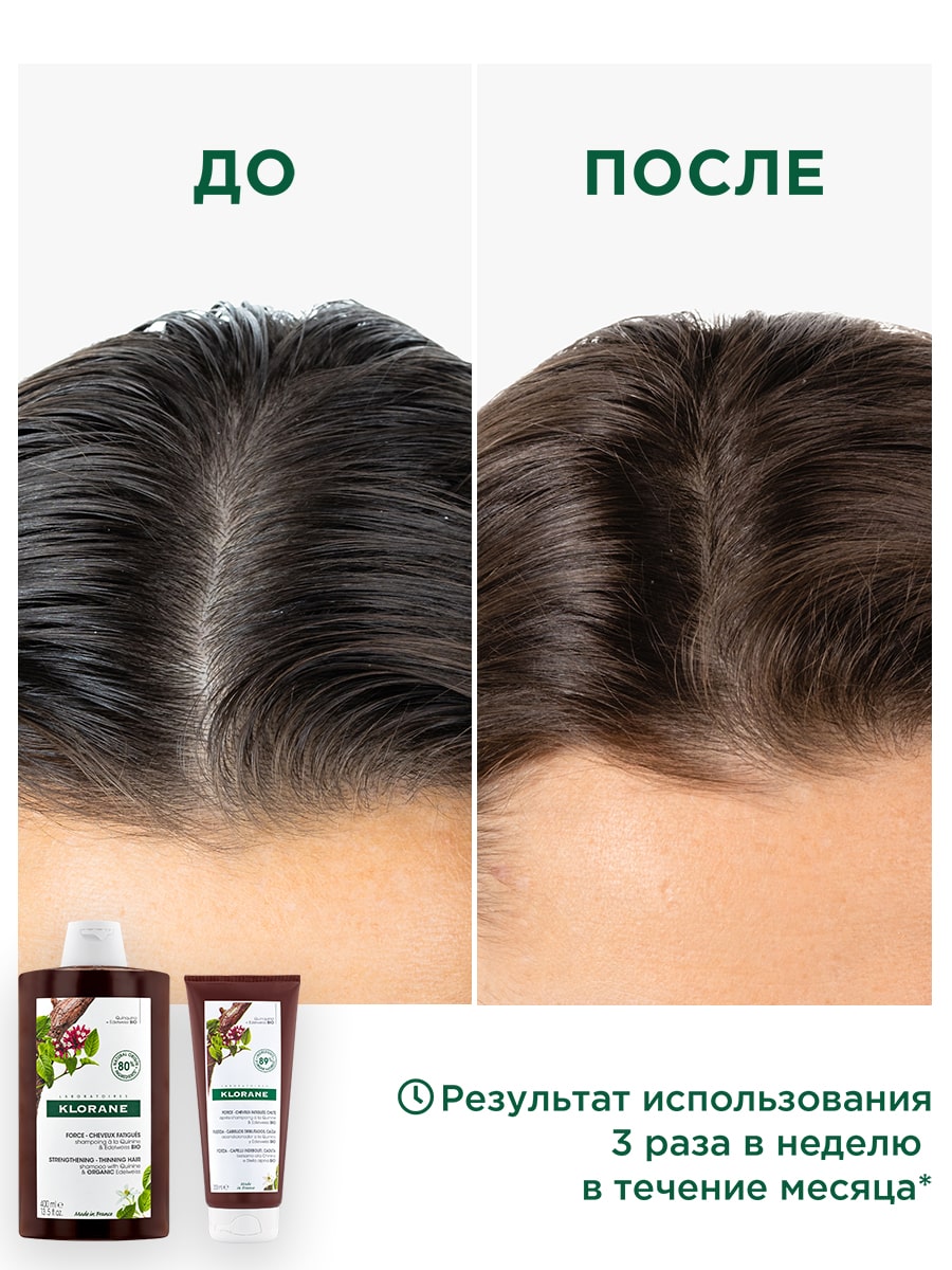 Клоран Шампунь с экстрактом хинина и органическим экстрактом эдельвейса, 400 мл (Klorane, Хинин) Клоран Шампунь с экстрактом хинина и органическим экстрактом эдельвейса, 400 мл (Klorane, Хинин) фото 5