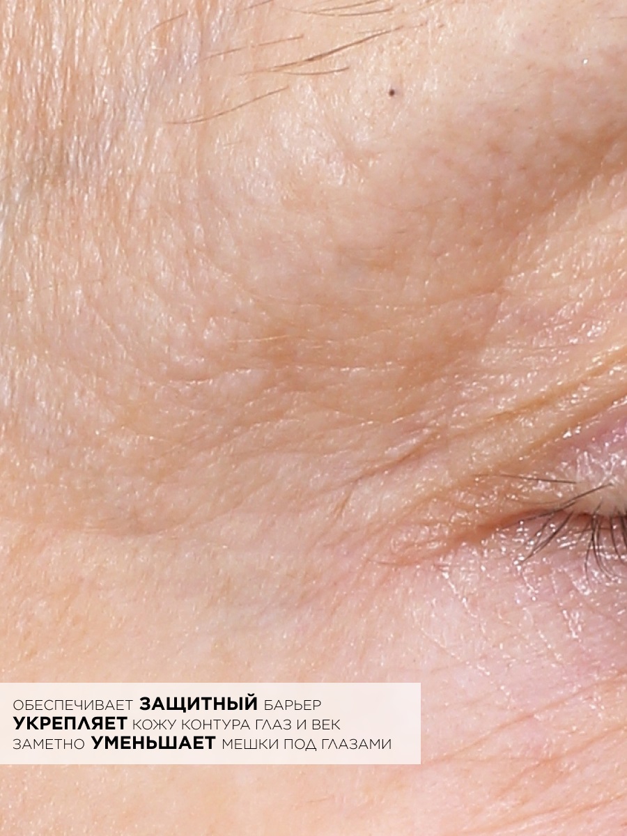 Топикрем Глобальный антивозрастной крем для контура глаз, 15 мл (Topicrem, AH3) Топикрем Глобальный антивозрастной крем для контура глаз, 15 мл (Topicrem, AH3) фото 5