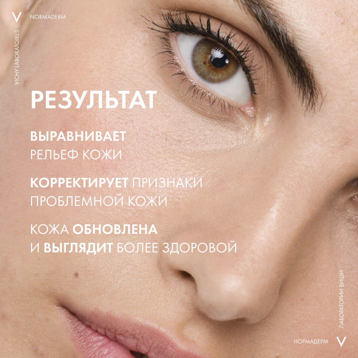Виши Пробиотическая обновляющая сыворотка против несовершенств кожи, 30 мл (Vichy, Normaderm) Виши Пробиотическая обновляющая сыворотка против несовершенств кожи, 30 мл (Vichy, Normaderm) фото 7