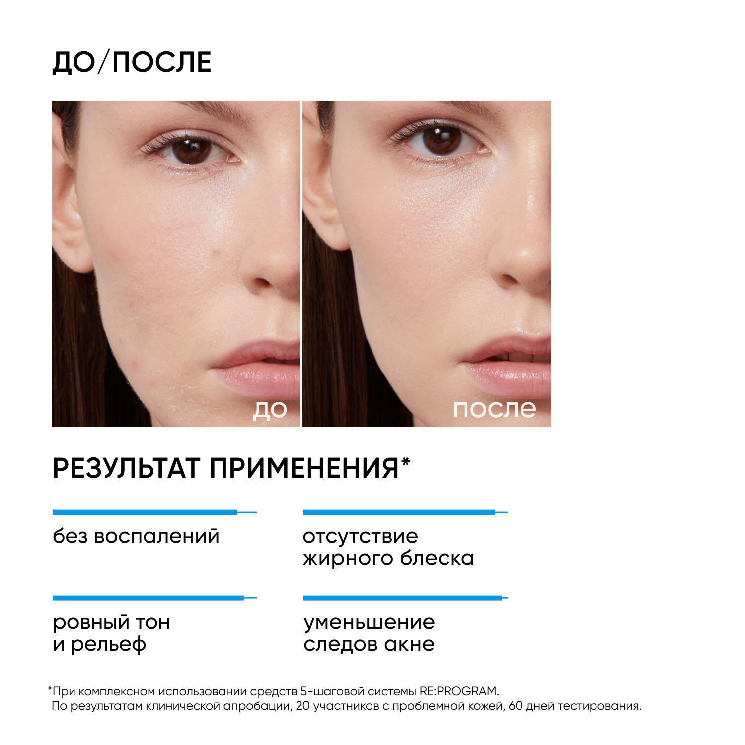Icon Skin Ночная мультикислотная сыворотка Night Miracle, 30 мл. фото