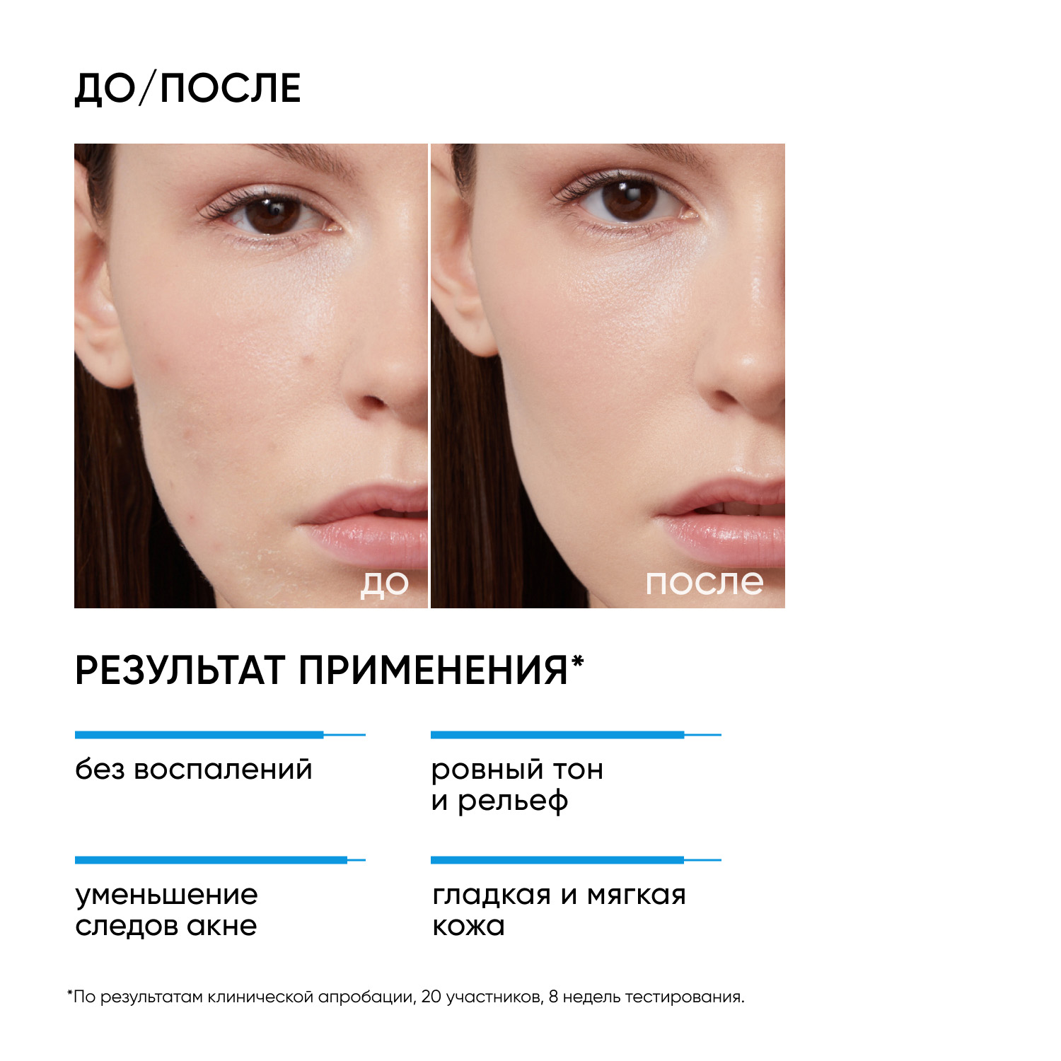 Айкон Скин Пилинг для проблемной кожи 18%, 30 мл (Icon Skin, Re:Program) фото 2