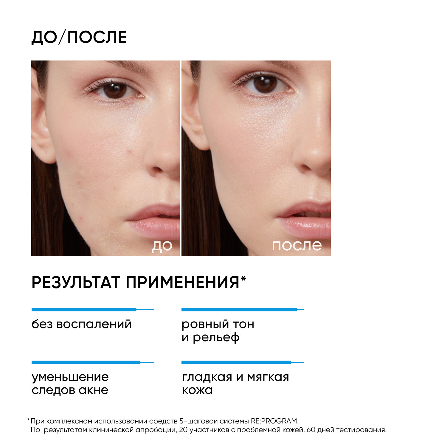 Айкон Скин Пилинг для проблемной кожи 11%, 30 мл (Icon Skin, Re:Program) фото 2