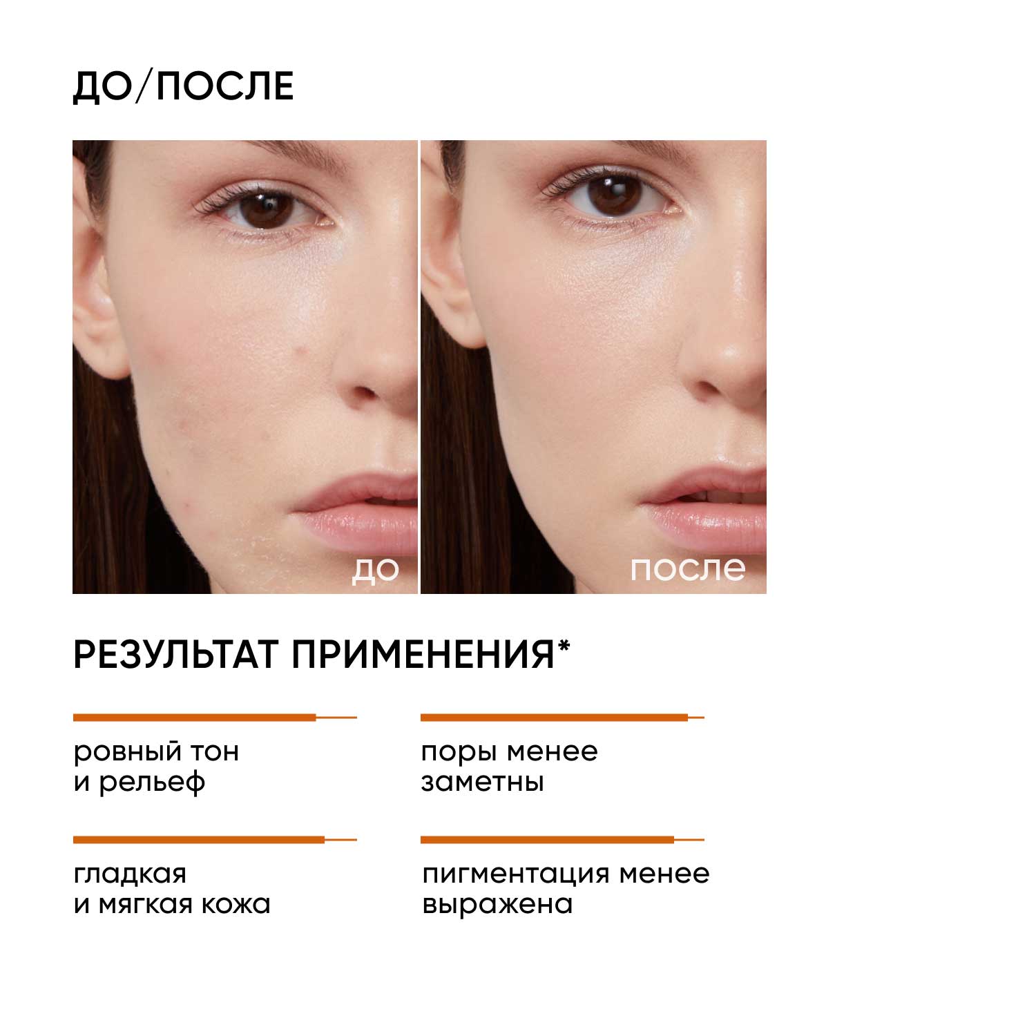 Айкон Скин Интенсивный миндальный пилинг 25% , 30 мл (Icon Skin, Smart) фото 2