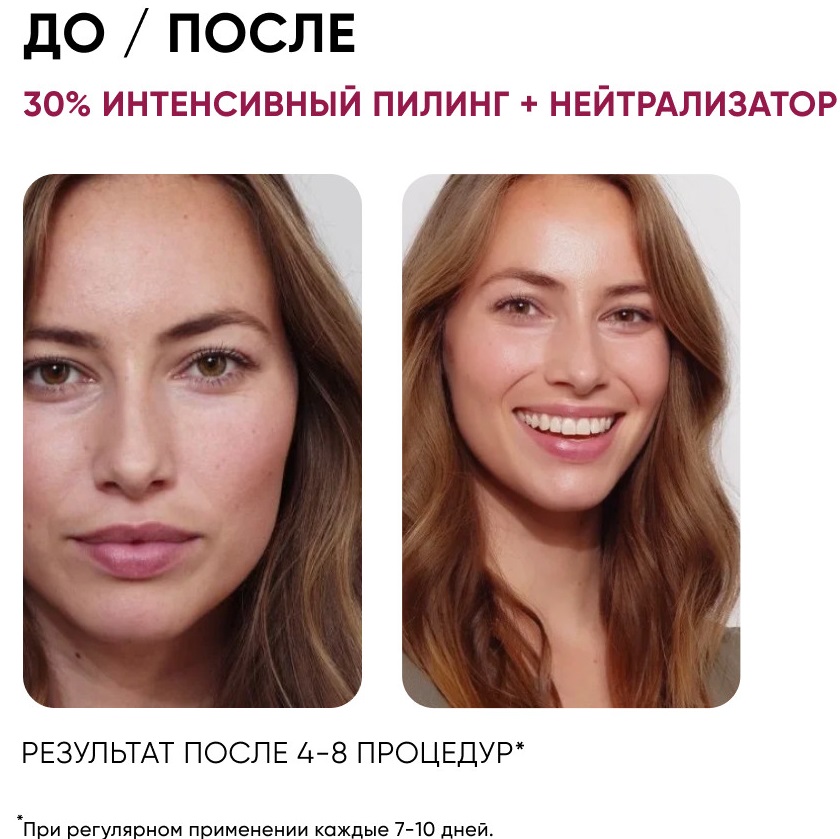 Айкон Скин Набор: Омолаживающий пилинг и нейтрализующий лосьон, 30% AHA (Icon Skin, Professional Series) фото 3