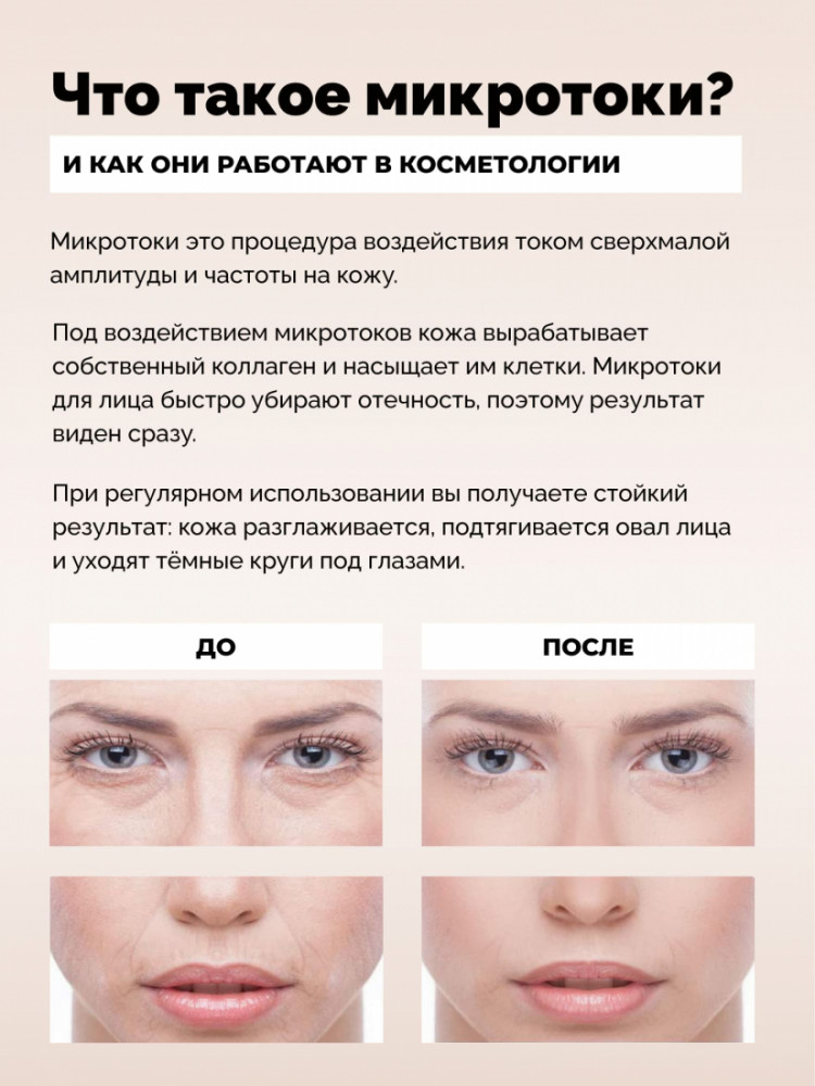 Гесс Микротоковый массажер для лица MT (Gess, Процедуры для лица) фото 13