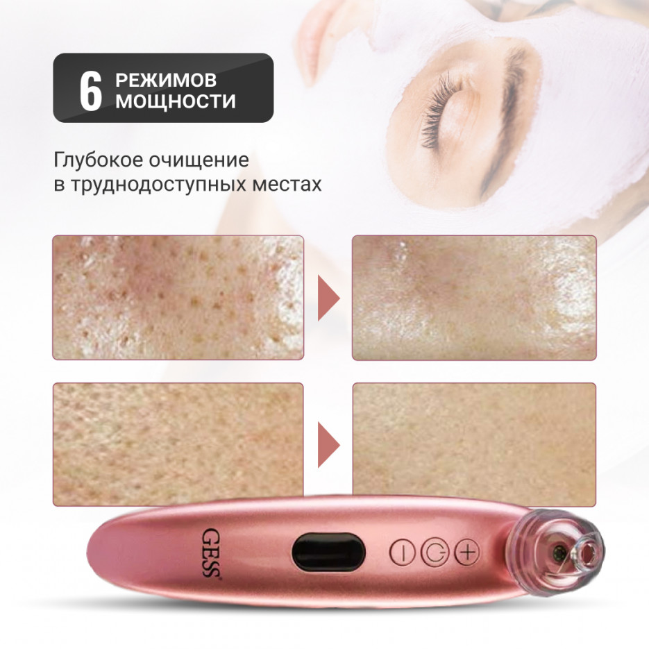 Гесс Аппарат для вакуумной чистки и шлифовки c микрокамерой Sleek (Gess, Процедуры для лица) Гесс Аппарат для вакуумной чистки и шлифовки c микрокамерой Sleek (Gess, Процедуры для лица) фото 9