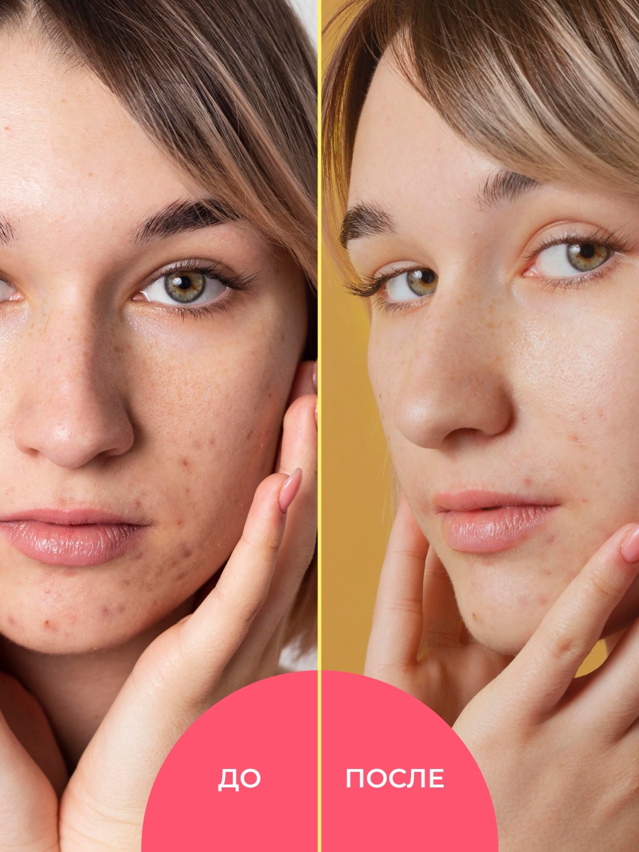 Сиберина Фито-пенка для умывания 