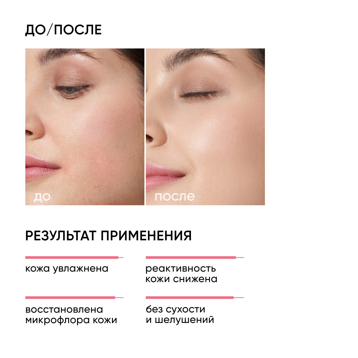 Айкон Скин Успокаивающий крем с комплексом пре- и пробиотиков SensiCare, 30 мл (Icon Skin, Re:Biom) фото 1