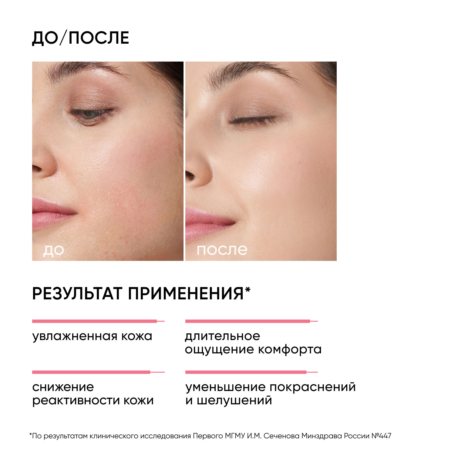 Icon Skin Увлажняющий гипоаллергенный крем для нормальной и сухой кожи Aqua Repair, 75 мл. фото