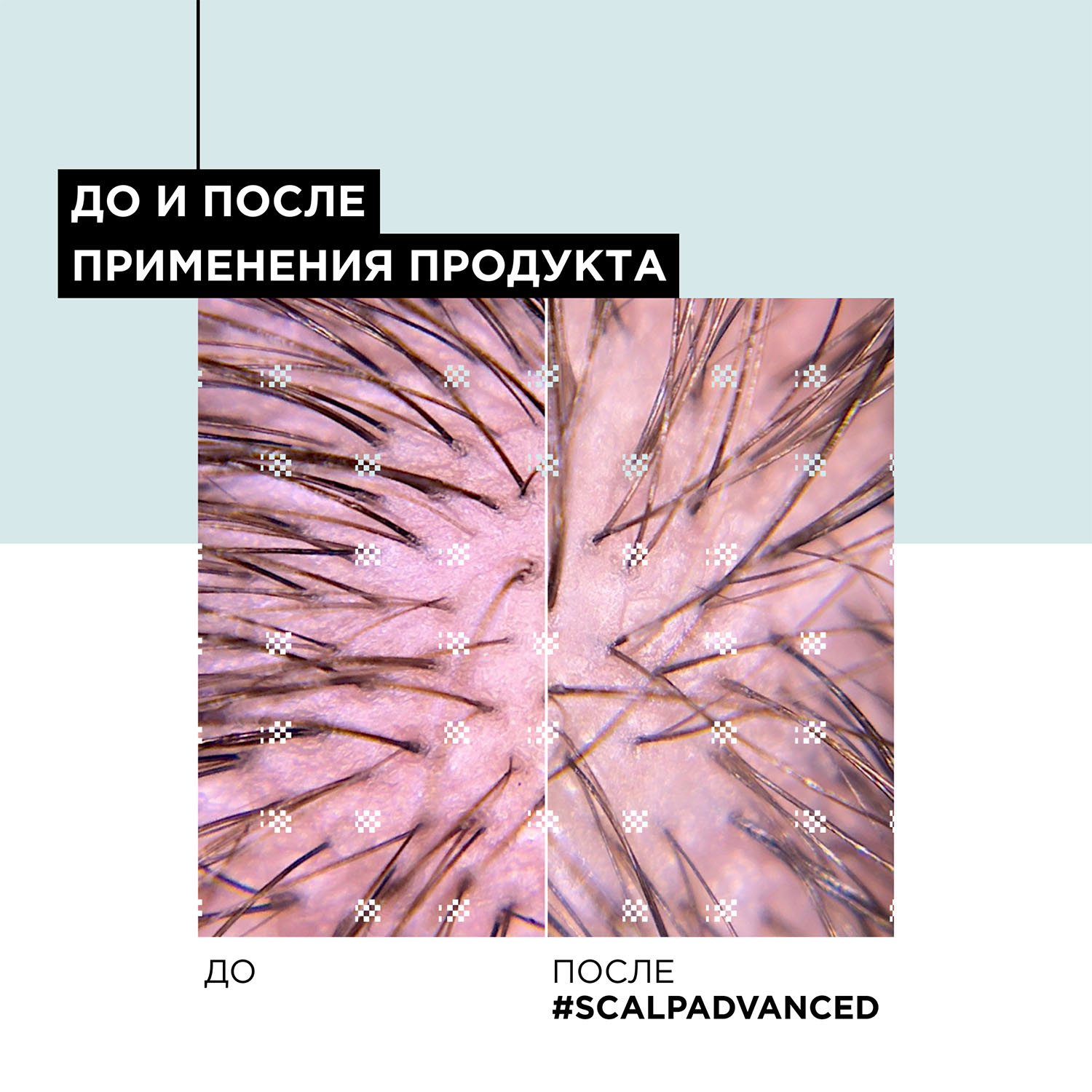 Лореаль Профессионель Шампунь Scalp Advanced регулирующий баланс чувствительной кожи головы, 300 мл (L'oreal Professionnel, Serie Expert) Лореаль Профессионель Шампунь Scalp Advanced регулирующий баланс чувствительной кожи головы, 300 мл (L'oreal Professionnel, Serie Expert) фото 9