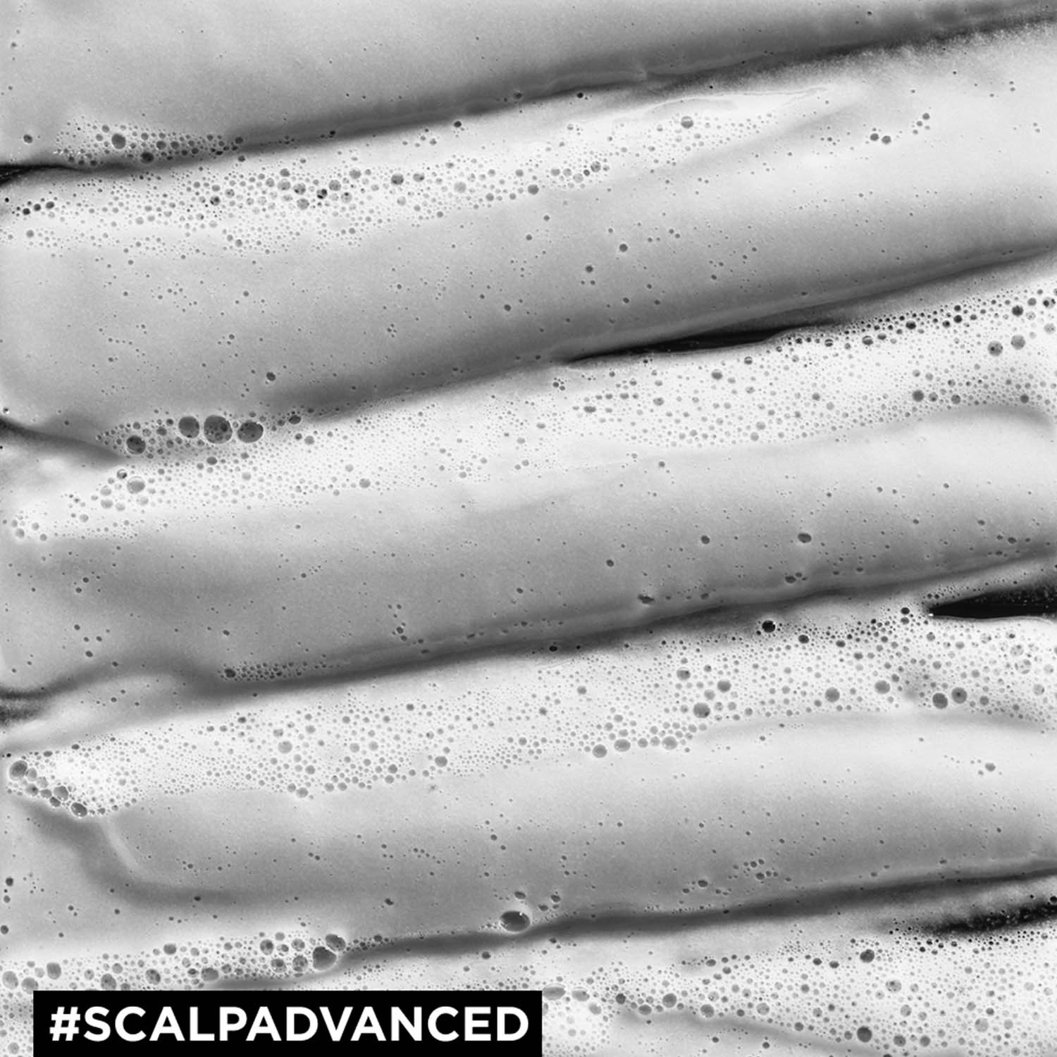 Лореаль Профессионель Шампунь-маска 2-в-1 Scalp Advanced для жирной кожи головы, 250 мл (L'oreal Professionnel, Serie Expert) Лореаль Профессионель Шампунь-маска 2-в-1 Scalp Advanced для жирной кожи головы, 250 мл (L'oreal Professionnel, Serie Expert) фото 5