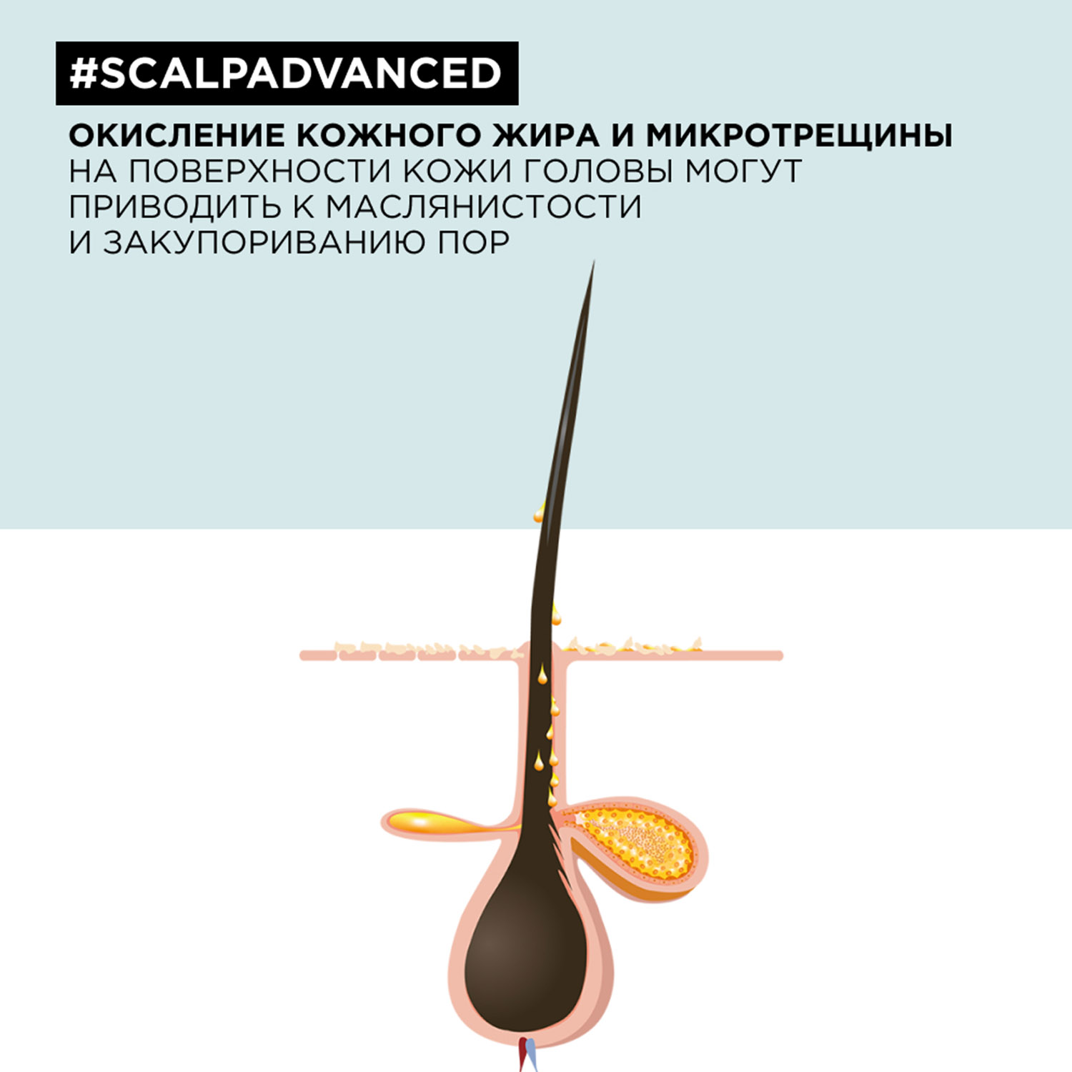 Лореаль Профессионель Шампунь-маска 2-в-1 Scalp Advanced для жирной кожи головы, 250 мл (L'oreal Professionnel, Serie Expert) Лореаль Профессионель Шампунь-маска 2-в-1 Scalp Advanced для жирной кожи головы, 250 мл (L'oreal Professionnel, Serie Expert) фото 7