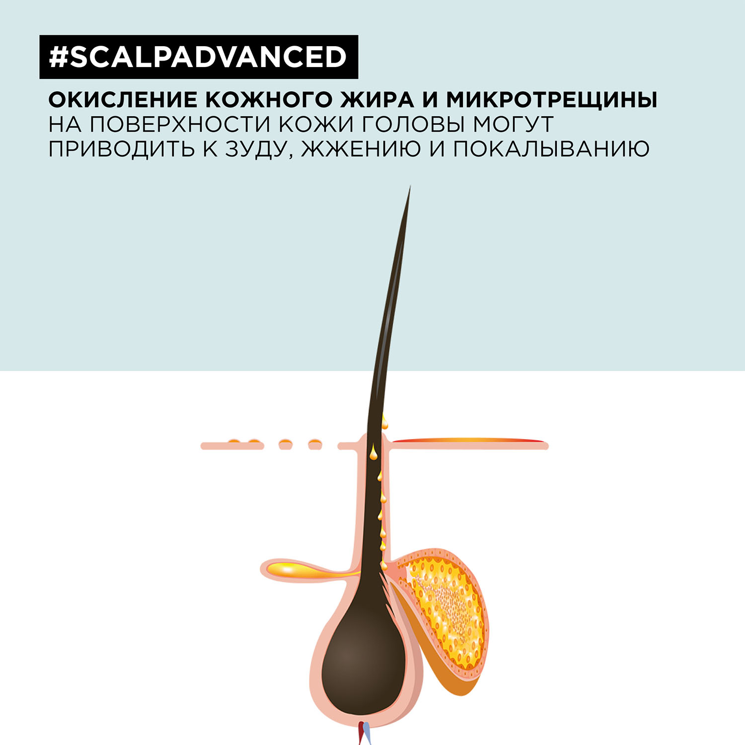 Лореаль Профессионель Гель-уход Scalp Advanced для чувствительной кожи головы, 200 мл (L'oreal Professionnel, Serie Expert) Лореаль Профессионель Гель-уход Scalp Advanced для чувствительной кожи головы, 200 мл (L'oreal Professionnel, Serie Expert) фото 5