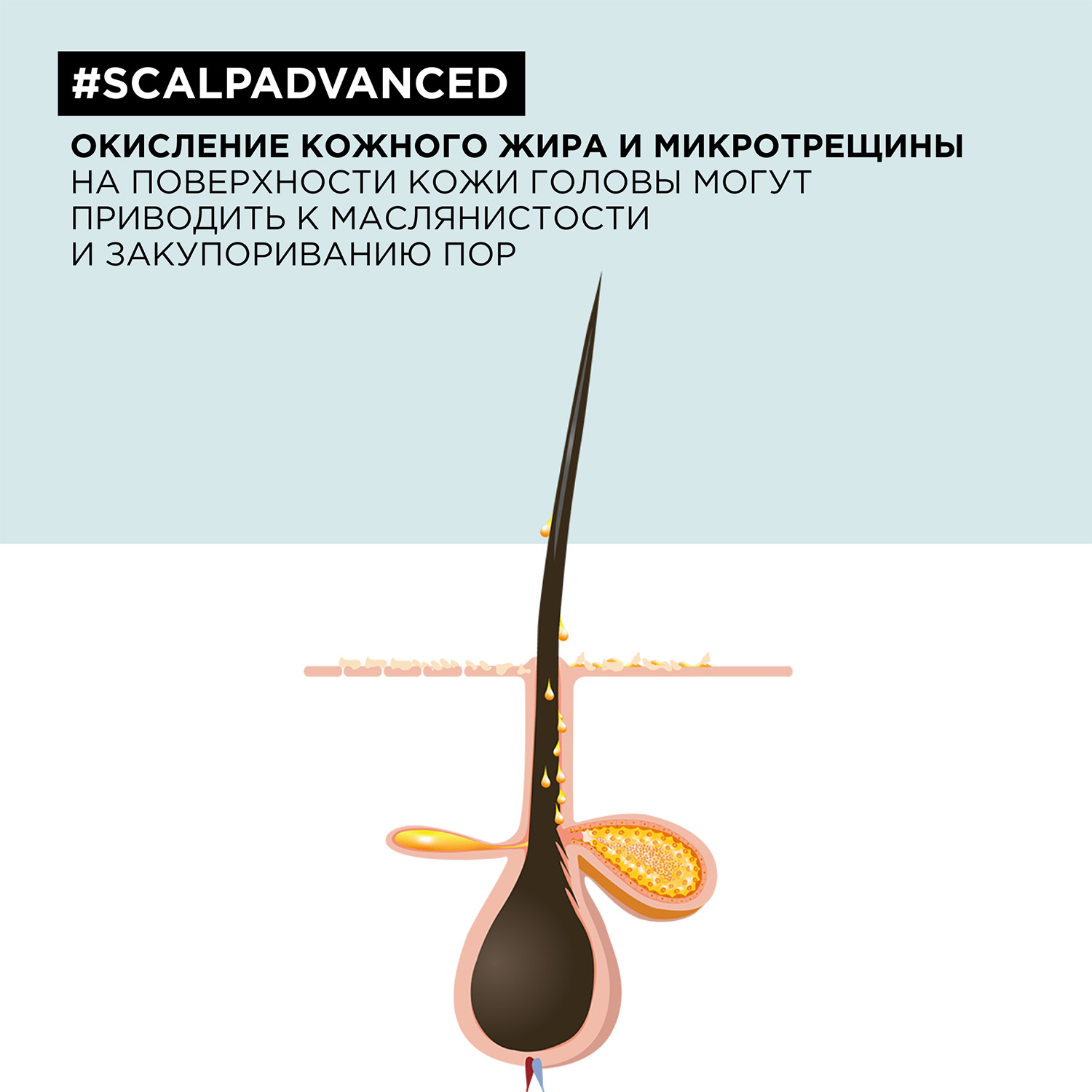 Лореаль Профессионель Шампунь Scalp Advanced для жирных волос, 300 мл (L'oreal Professionnel, Serie Expert) фото 4