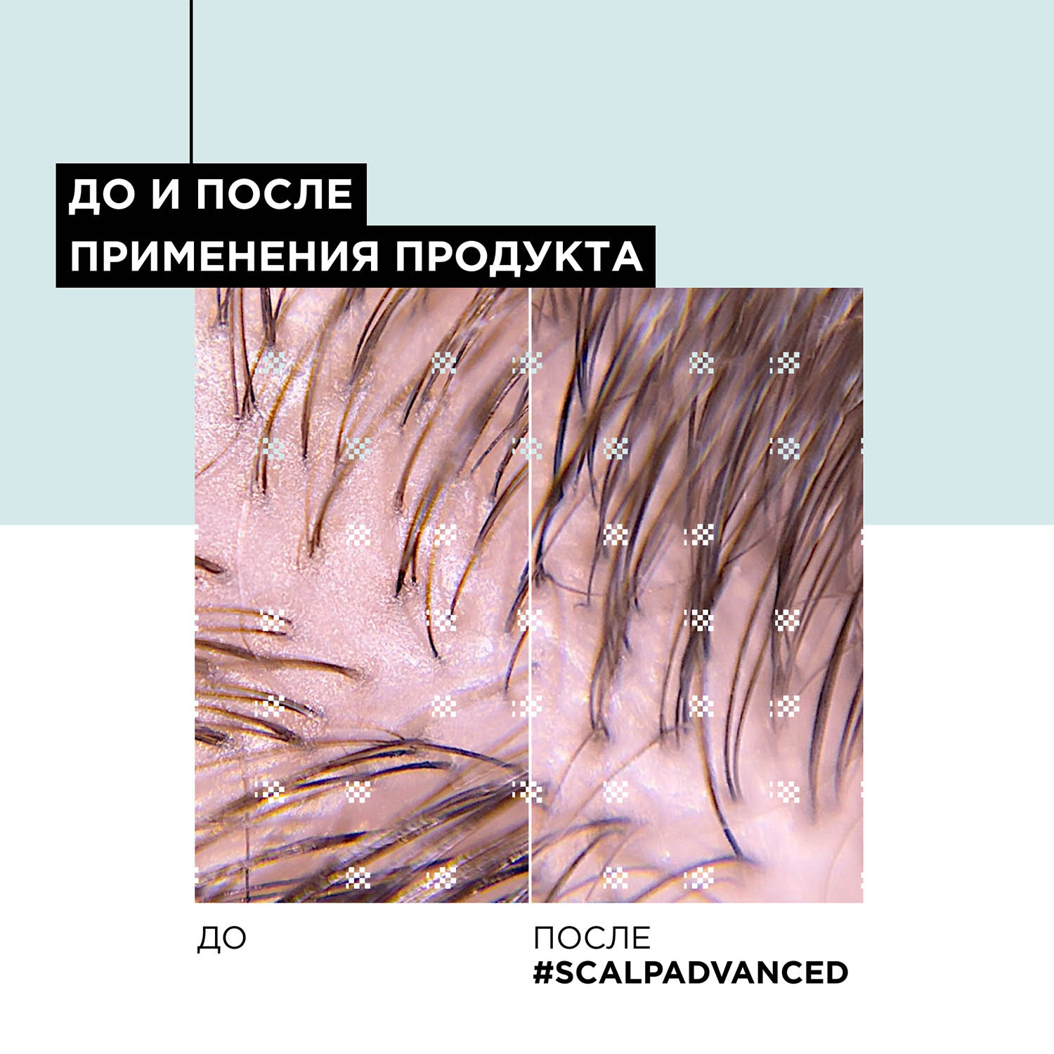 Лореаль Профессионель Шампунь Scalp Advanced для жирных волос, 300 мл (L'oreal Professionnel, Serie Expert) фото 5