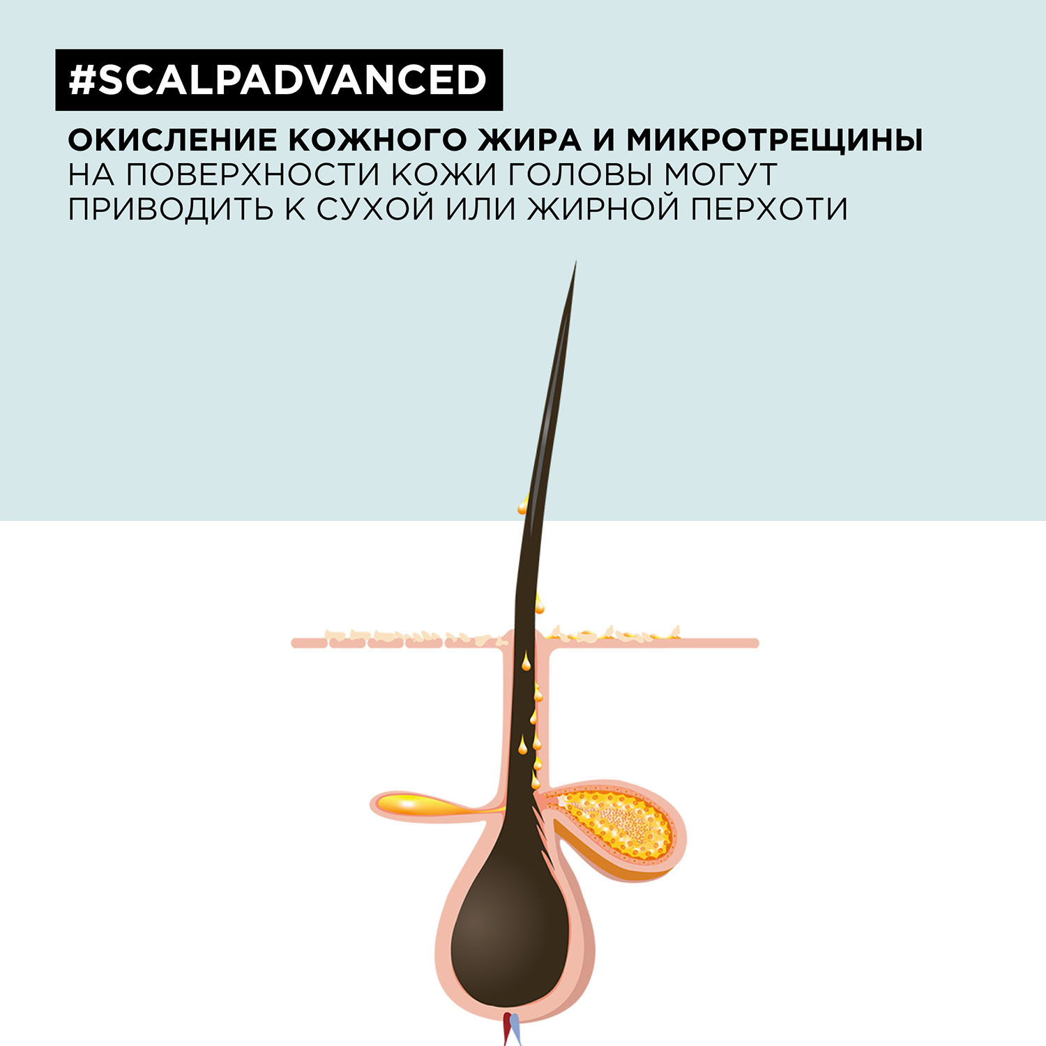 Лореаль Профессионель Шампунь Scalp Advanced против перхоти для всех типов волос, 300 мл (L'oreal Professionnel, Serie Expert) фото 4