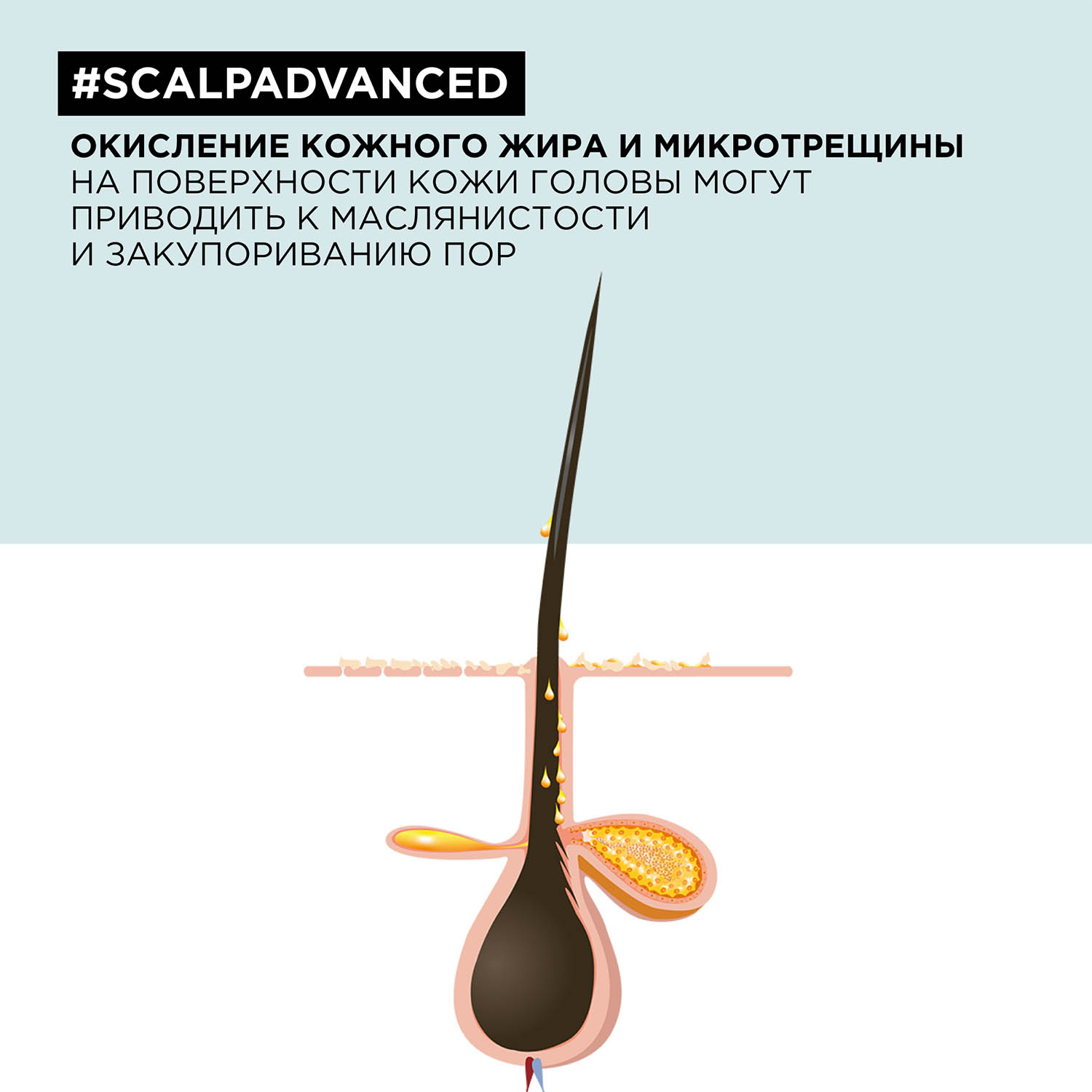 Лореаль Профессионель Шампунь Scalp Advanced для жирных волос, 500 мл (L'oreal Professionnel, Serie Expert) фото 4