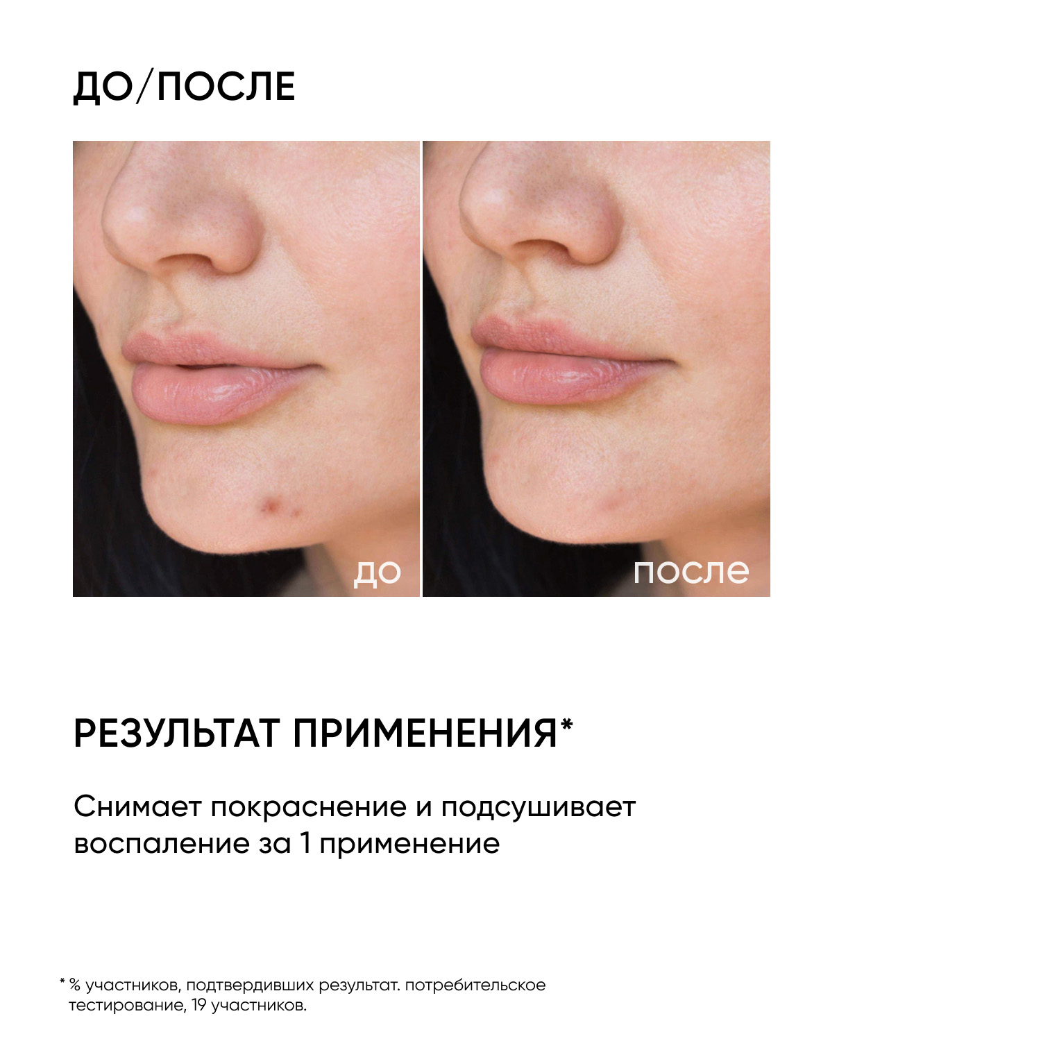 Айкон Скин Точечное SOS-средство от воспалений, 20 мл (Icon Skin, Re:Program) Айкон Скин Точечное SOS-средство от воспалений, 20 мл (Icon Skin, Re:Program) фото 1