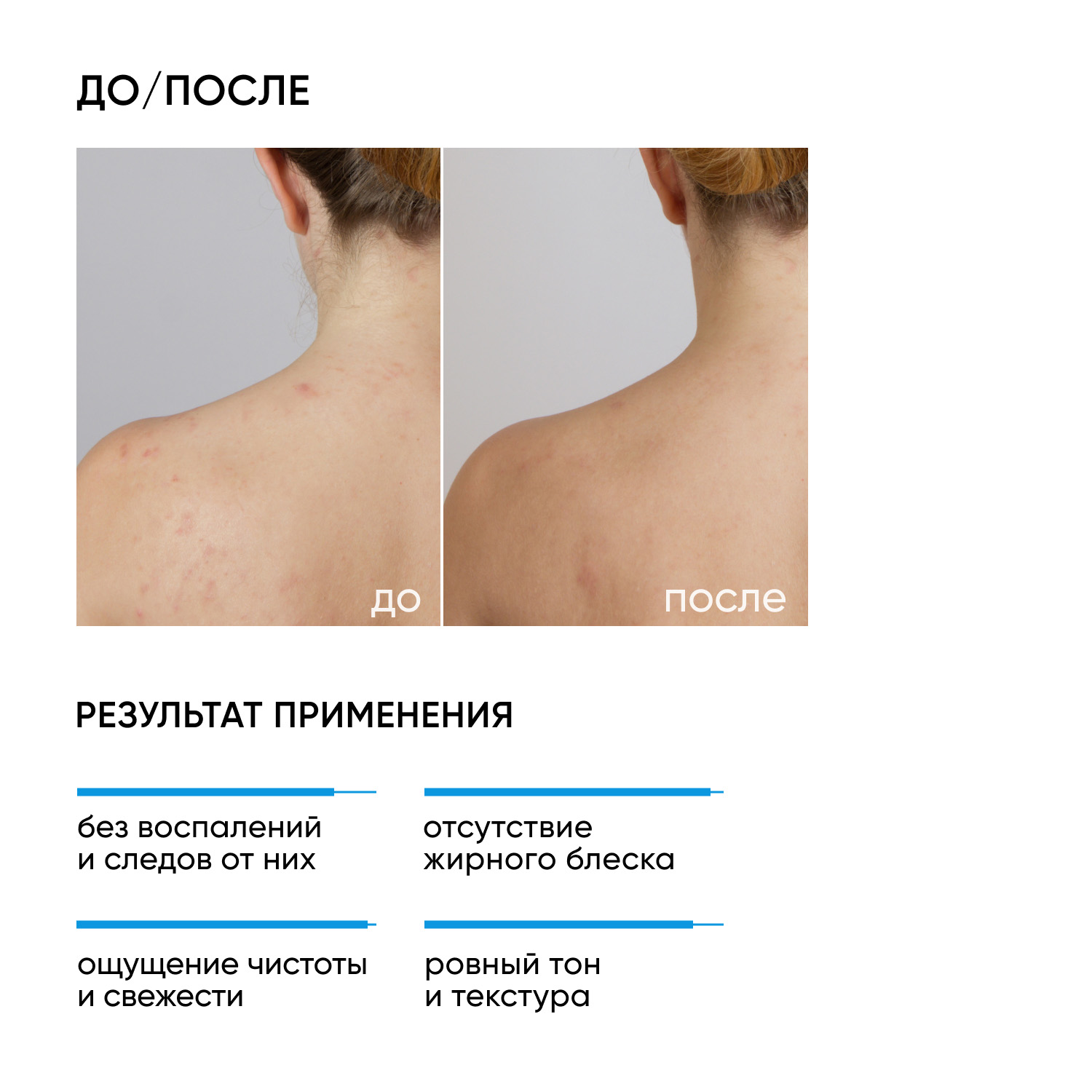 Айкон Скин Противовоспалительный очищающий гель для лица и тела Blemish Control, 250 мл (Icon Skin, Re:Program) фото 1