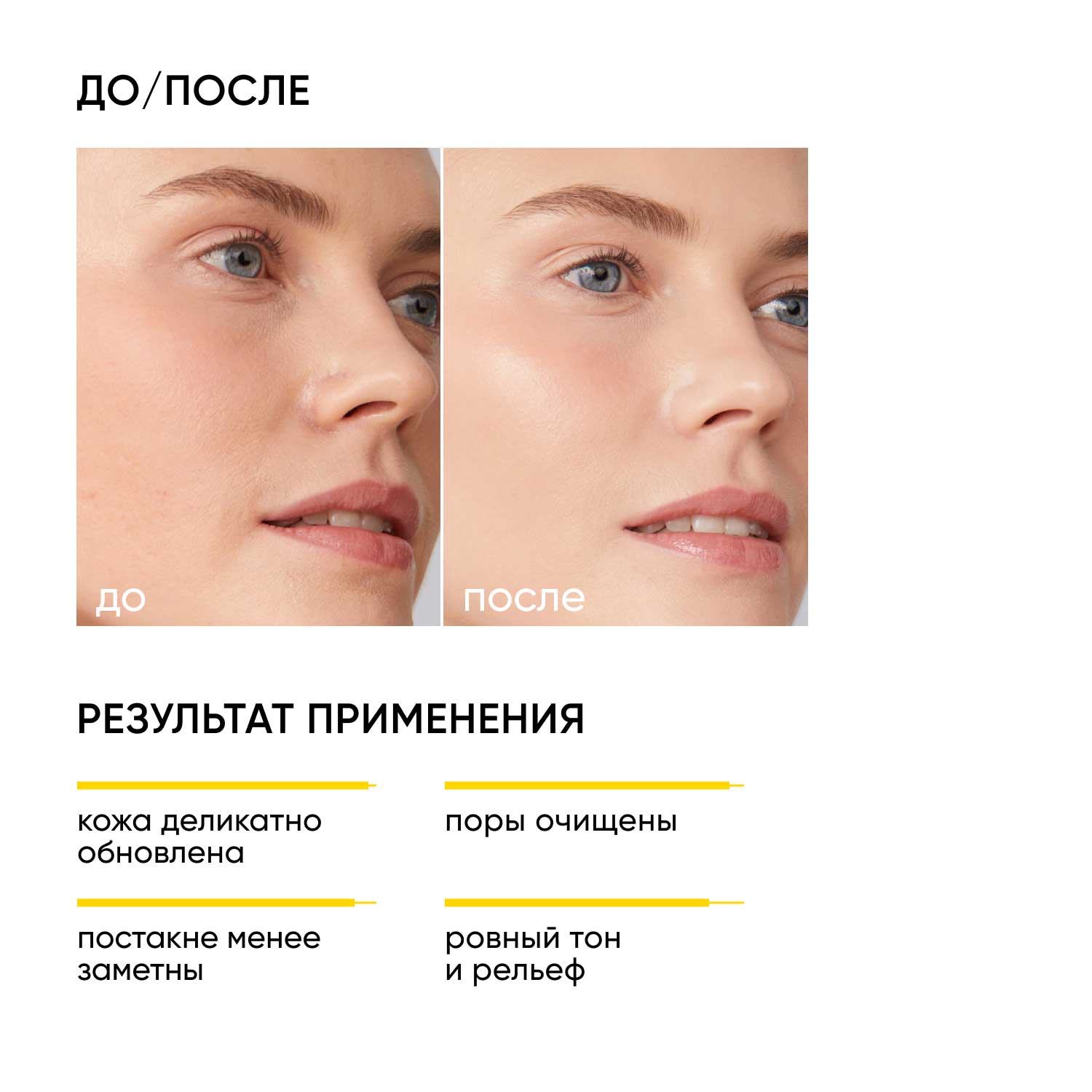 Айкон Скин Очищающий гель для умывания с кислотами Soft Renew, 150 мл (Icon Skin, Smart) фото 1