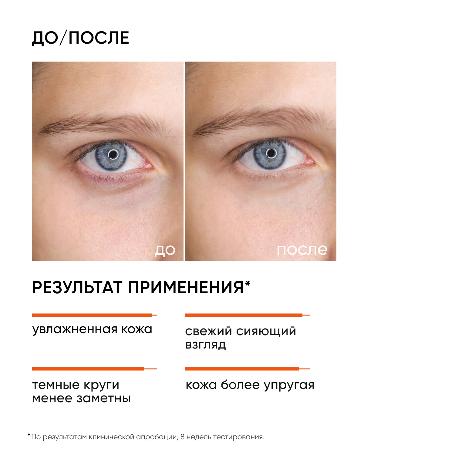 Icon Skin Крем для кожи вокруг глаз Vitamin C Force против морщин и темных кругов под глазами, 20 мл. фото