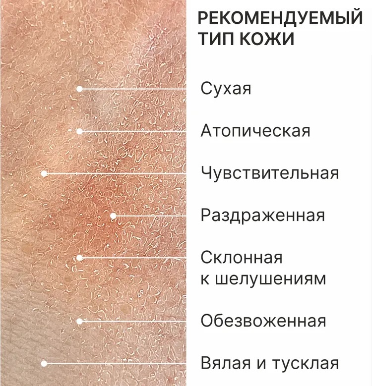 ТерафитоАбель Высококонцентрированный восстанавливающий мультикрем для лица и тела Intensive-Cure Ointment 0+, 30 мл (TheraphytoAbel, Theraphyto) фото 5