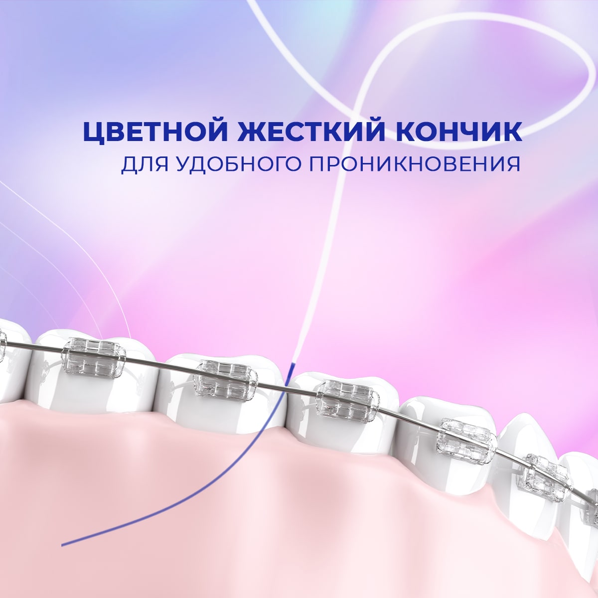 Сплат Ортодонтическая зубная нить Smilex Ortho+ с ароматом свежей мяты, 30 отдельных нитей (Splat, Ortho) фото 2