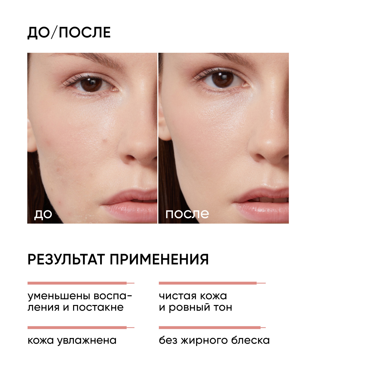Icon Skin Корректирующая крем-сыворотка на основе 10 азелаиновой кислоты, 50 мл. фото