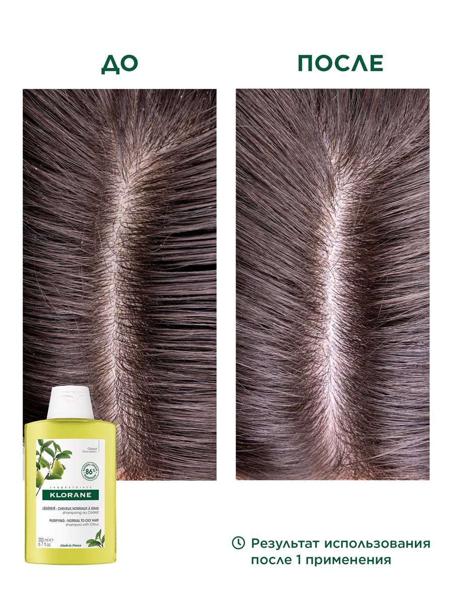 Клоран Шампунь с мякотью цитрона, 200 мл (Klorane, Цитрон) фото 4