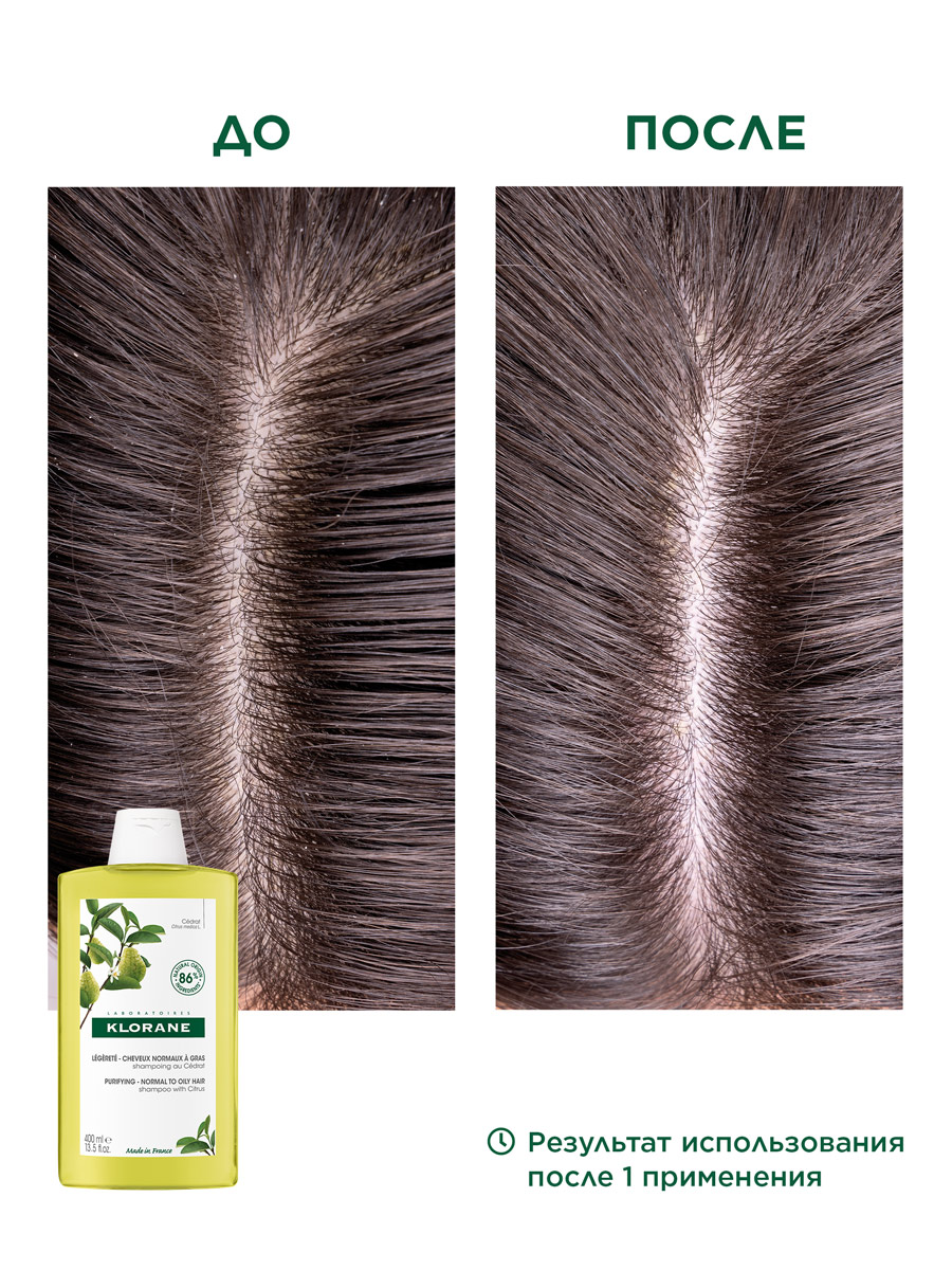 Клоран Шампунь с мякотью цитрона, 400 мл (Klorane, Цитрон) фото 4