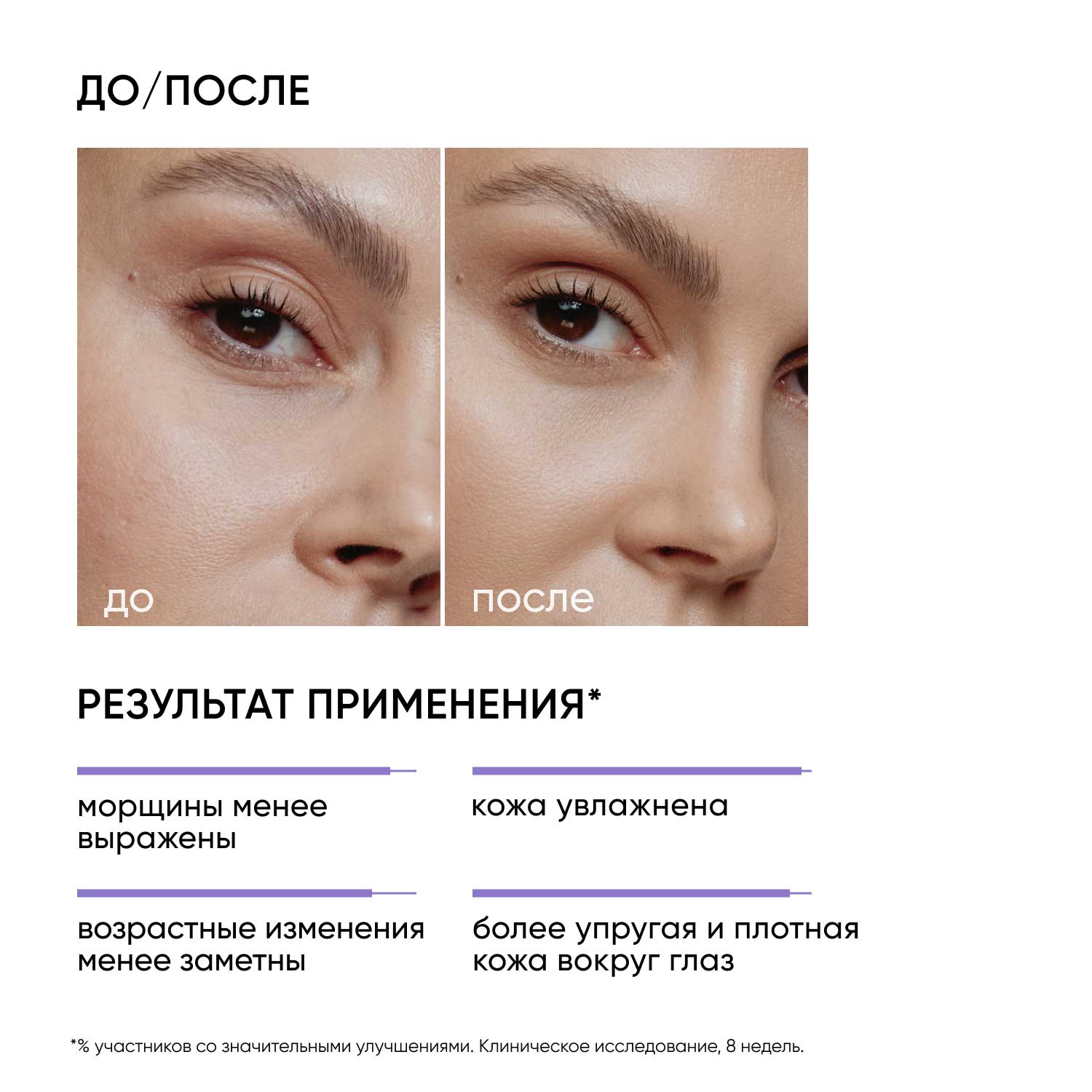 Айкон Скин Ночной крем для кожи вокруг глаз Age Eraser на основе 0,05% ретинола, 20 мл (Icon Skin, Smart) фото 1