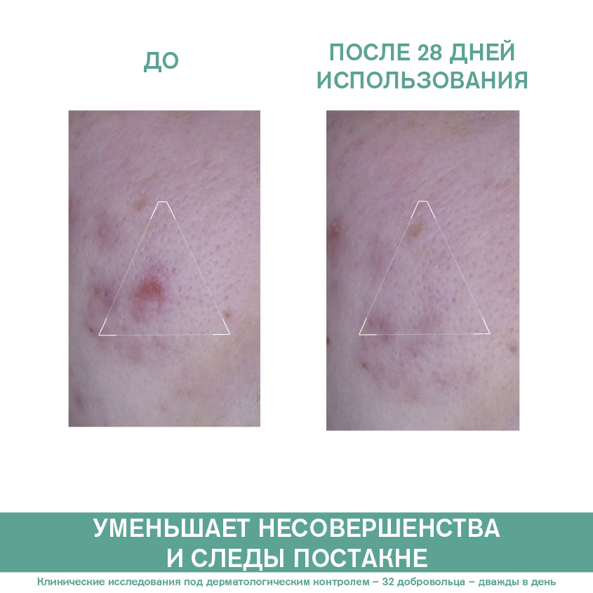 Урьяж Универсальный уход против несовершенств кожи 3 Regul+, 40 мл (Uriage, Hyseac) фото 2