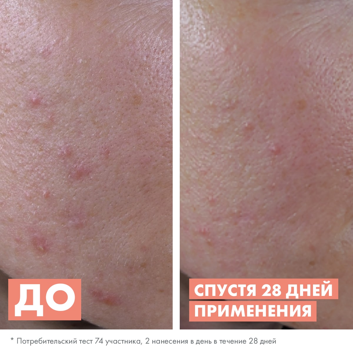 Авен Обновляющая сыворотка для жирной и комбинированной кожи, 30 мл (Avene, Cleanance) фото 4