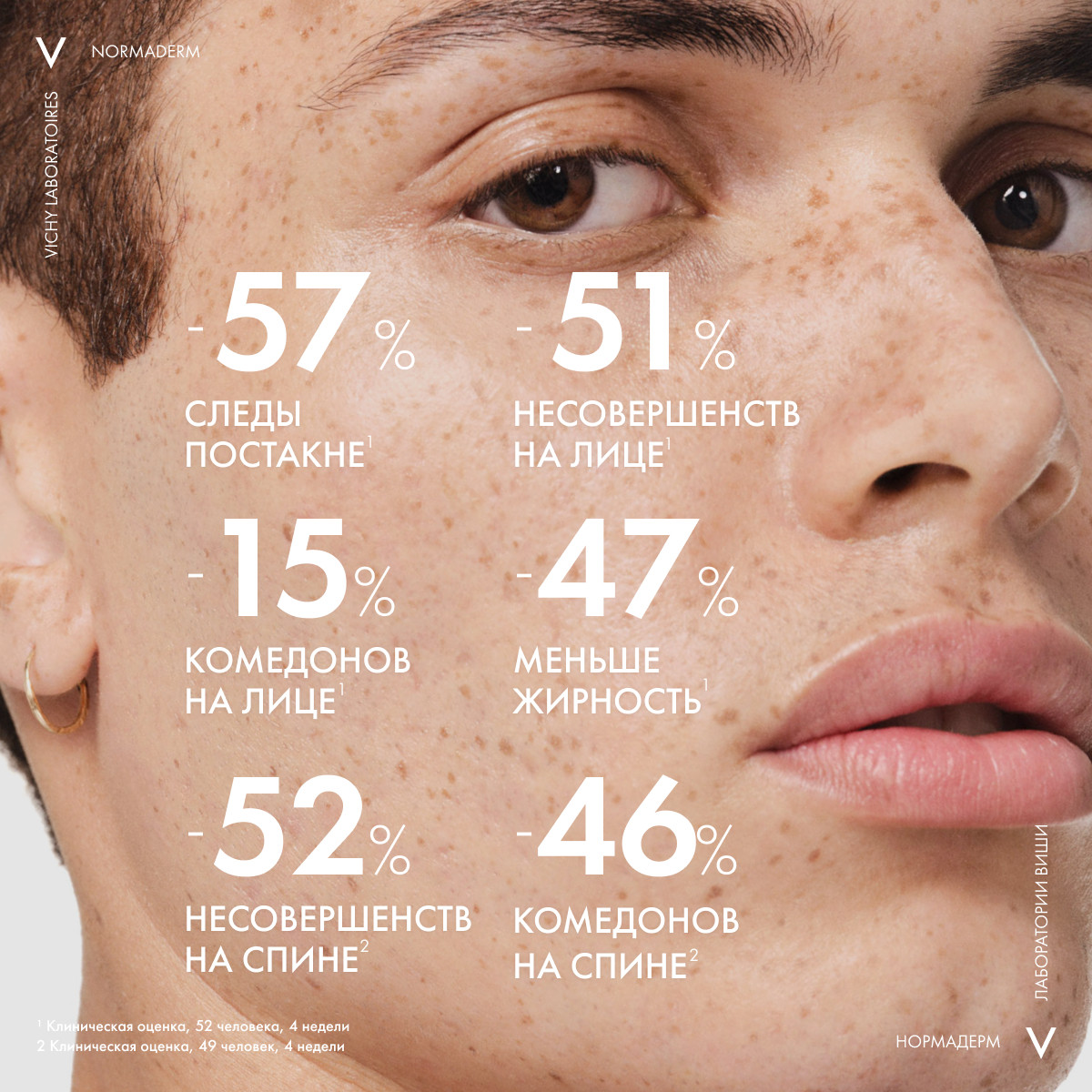 Виши Гель-сыворотка очищающая с эффектом пилинга, 125 мл (Vichy, Normaderm) фото 3