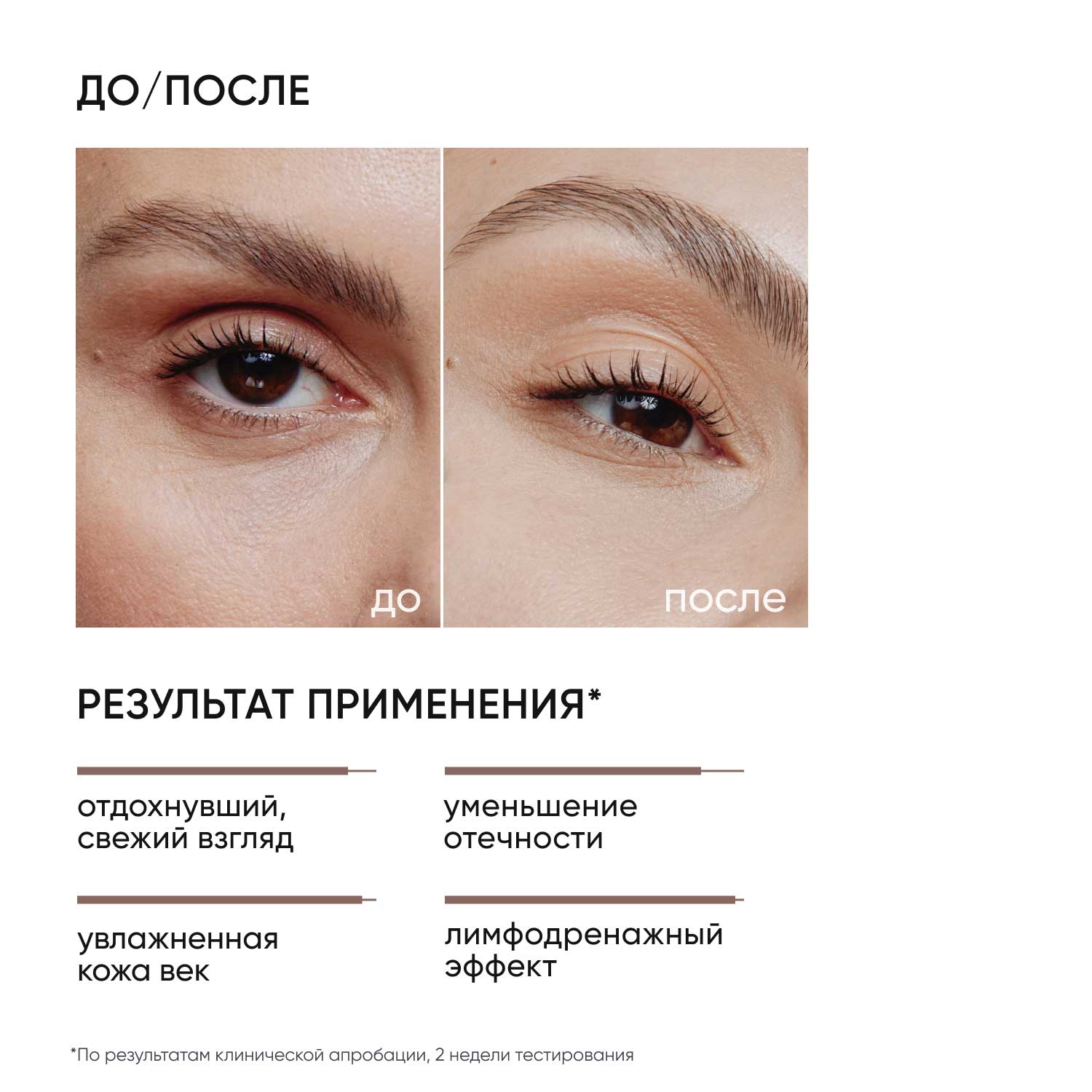 Айкон Скин Крем-гель для кожи вокруг глаз от отеков Eyes Yoga, 20 мл (Icon Skin, Smart) фото 1