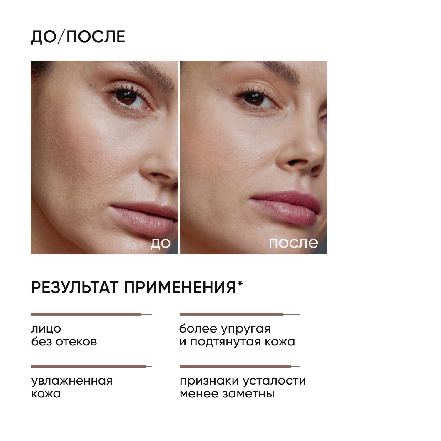 Icon Skin Лимфодренажный тоник Skin Gym, 150 мл. фото