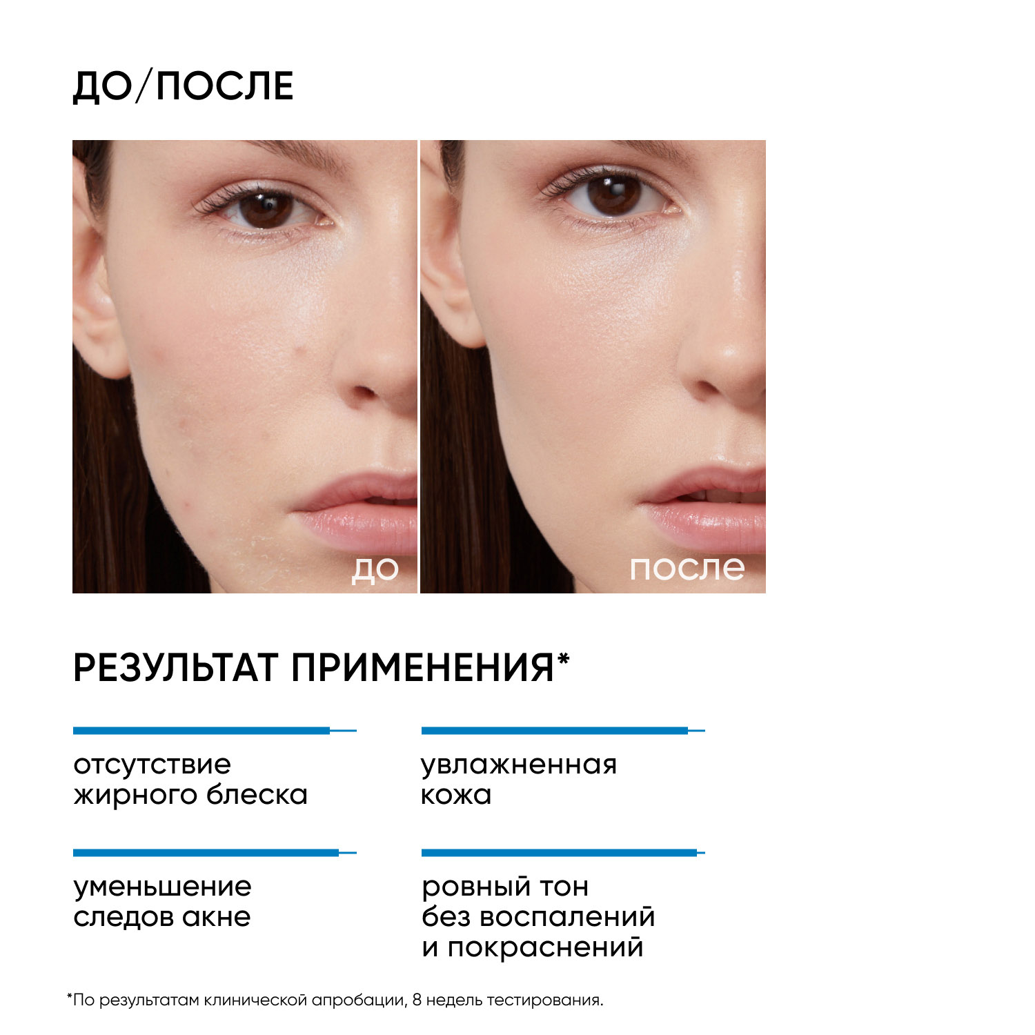 Icon Skin Увлажняющий крем для кожи, склонной к акне Moist  Heal, 50 мл. фото