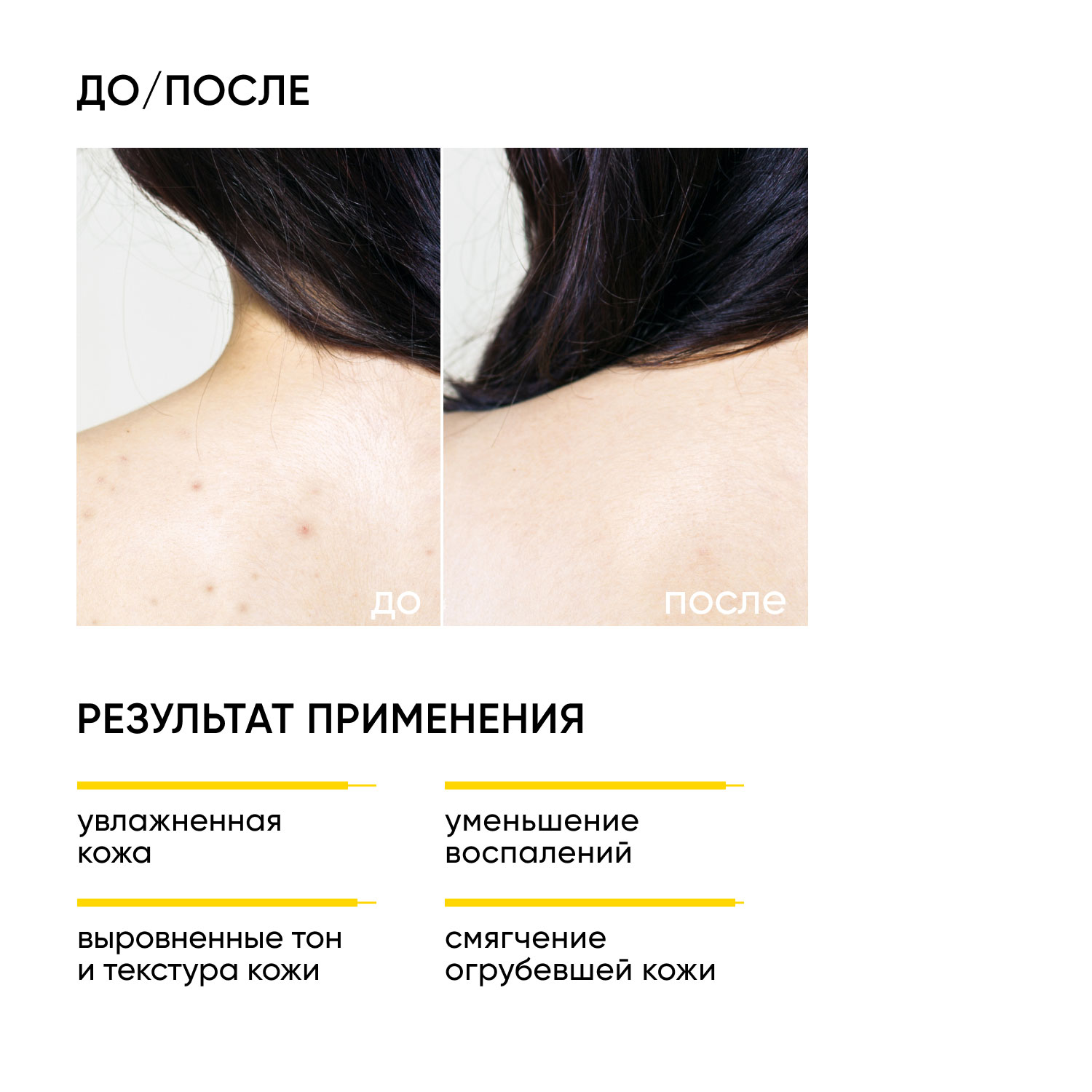 Icon Skin Обновляющий крем для тела с кислотами Skin Renewal, 200 мл. фото