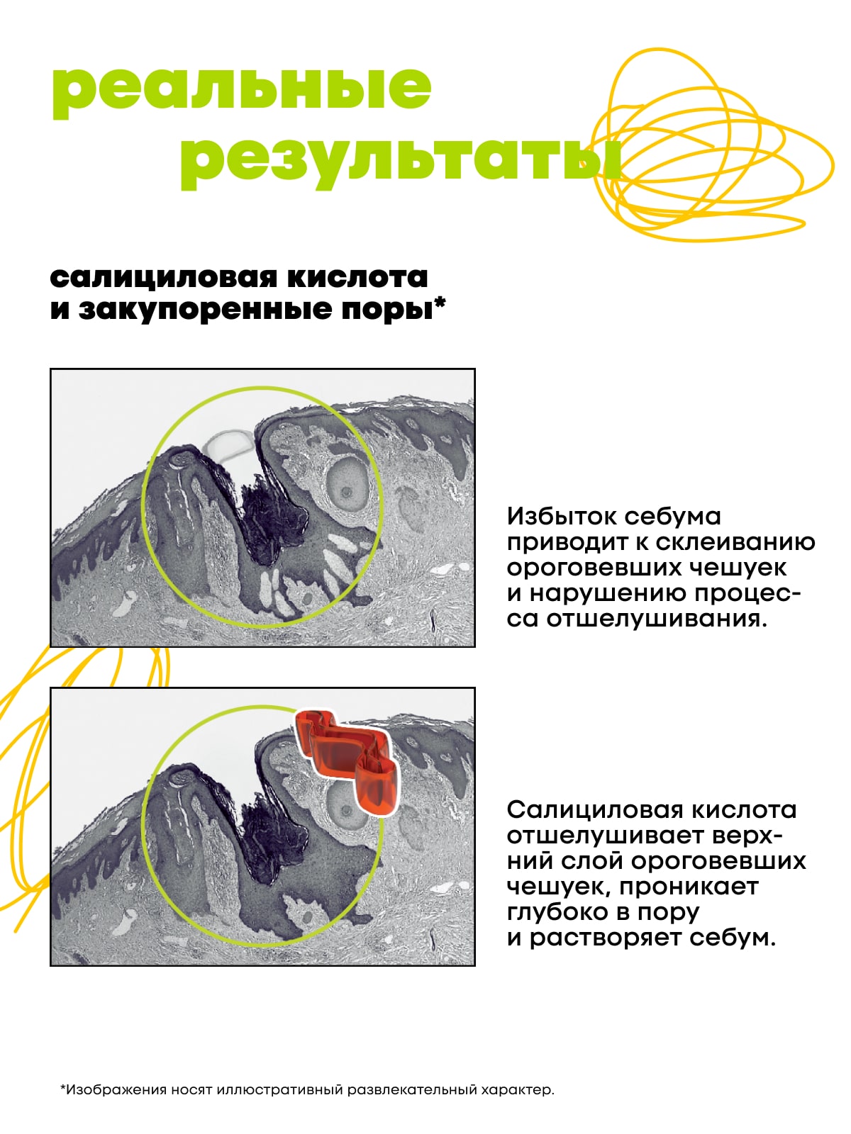 Де_Код Лосьон против черных точек, 150 мл (De_Code, Clear Key) фото 8
