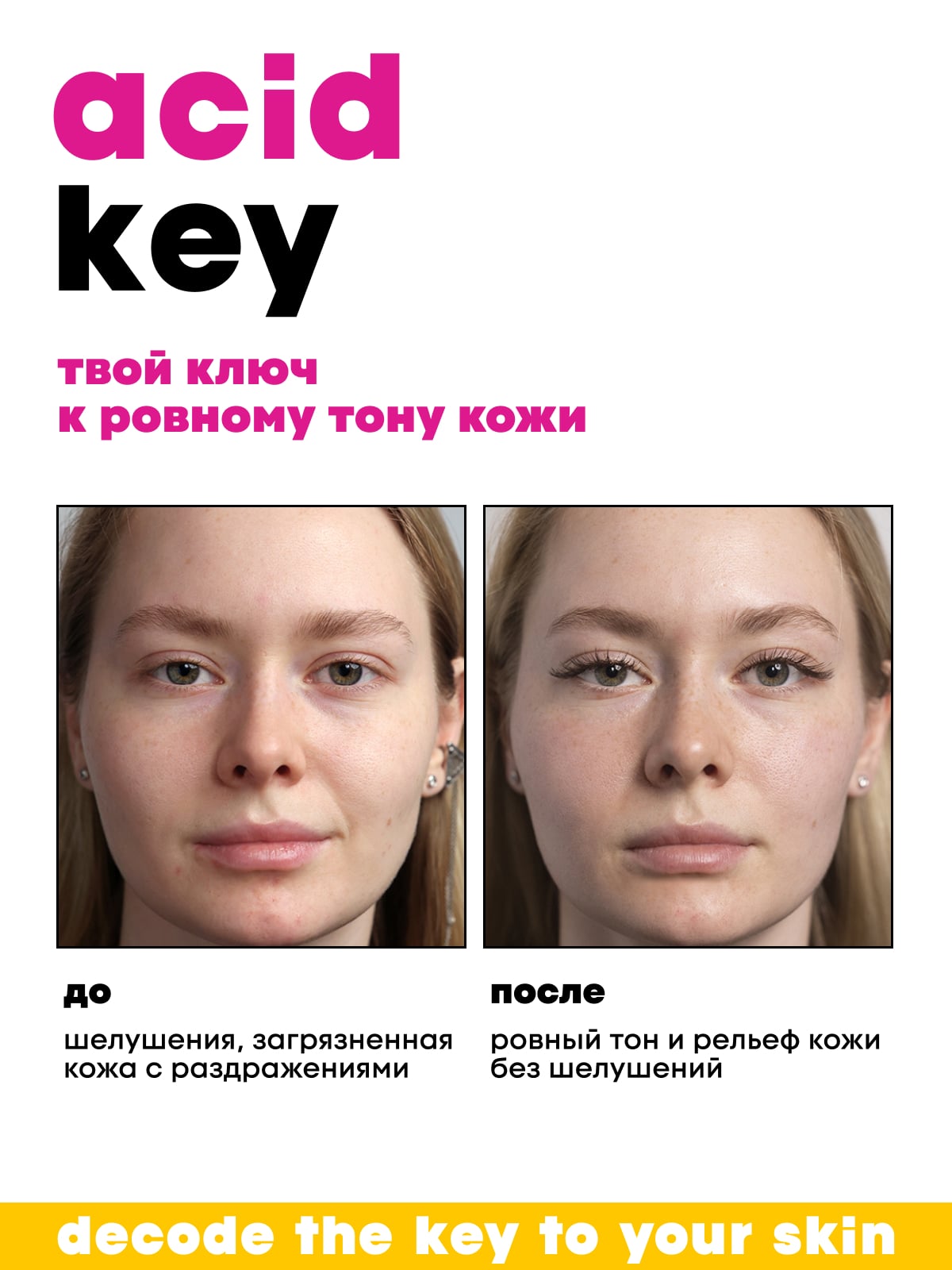 Де_Код Обновляющий тоник, 150 мл (De_Code, Acid Key) фото 4