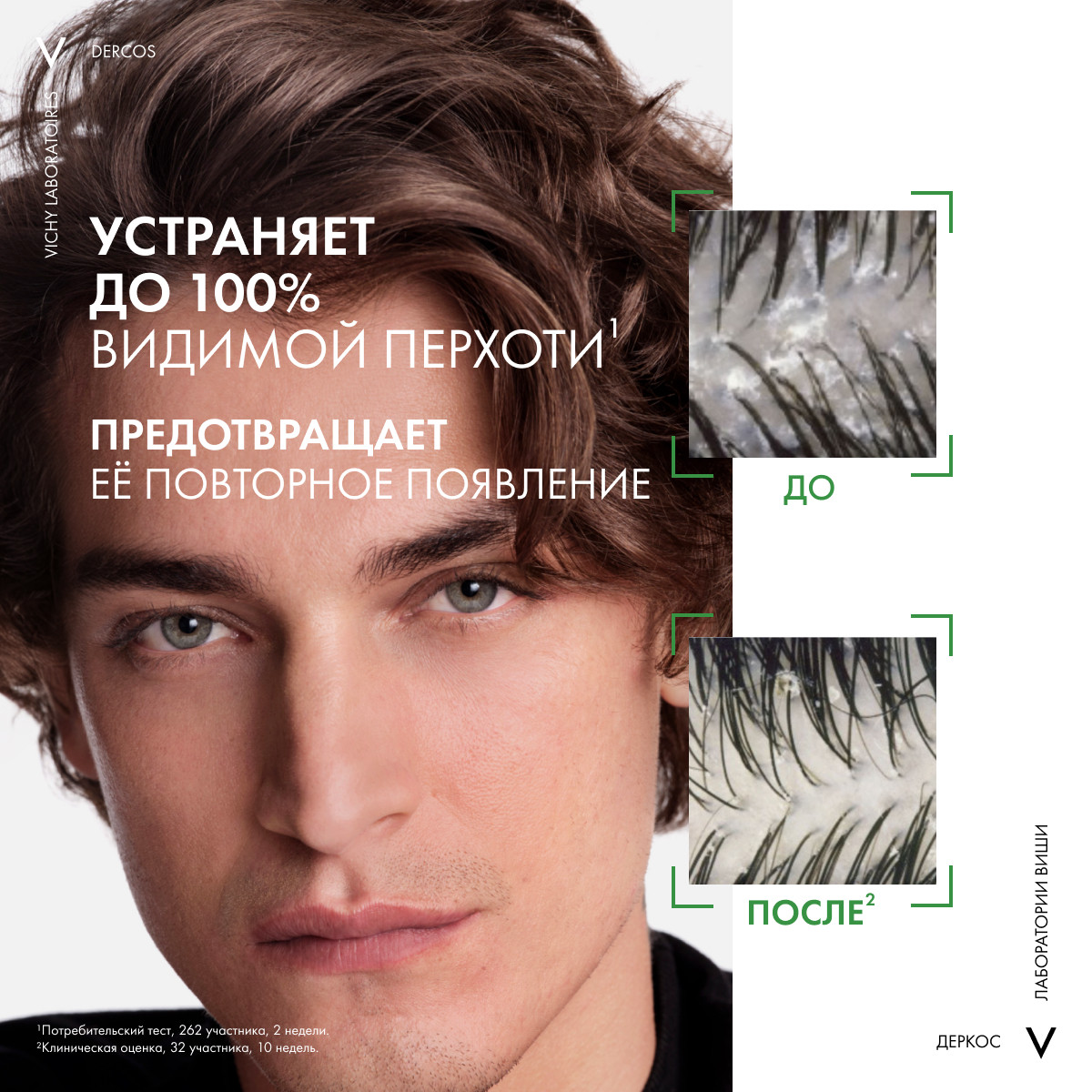 Виши Интенсивный увлажняющий шампунь-уход против перхоти 2в1, 200 мл (Vichy, Dercos) фото 5