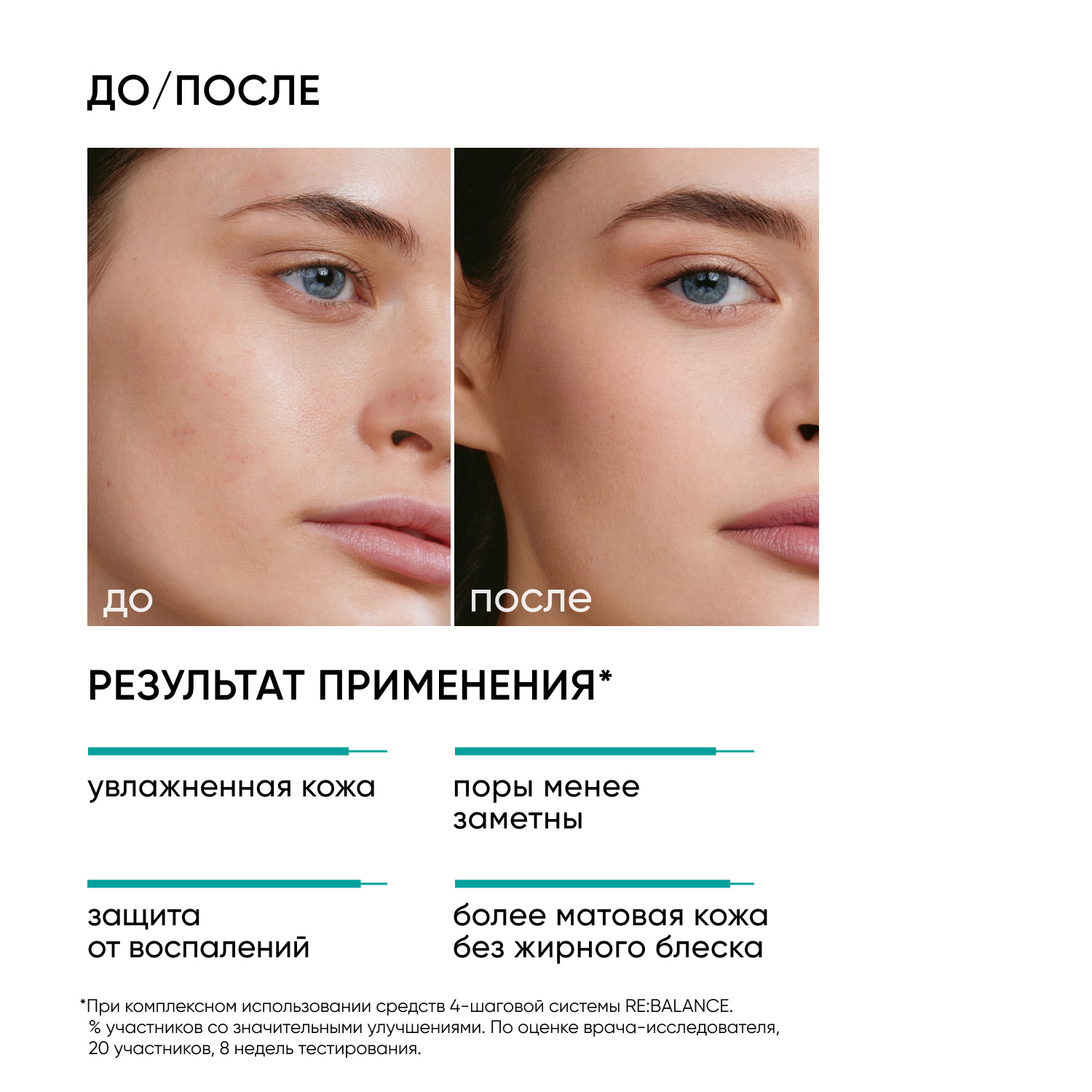 Icon Skin Балансирующий тоник-активатор Herbal Power, 150 мл. фото
