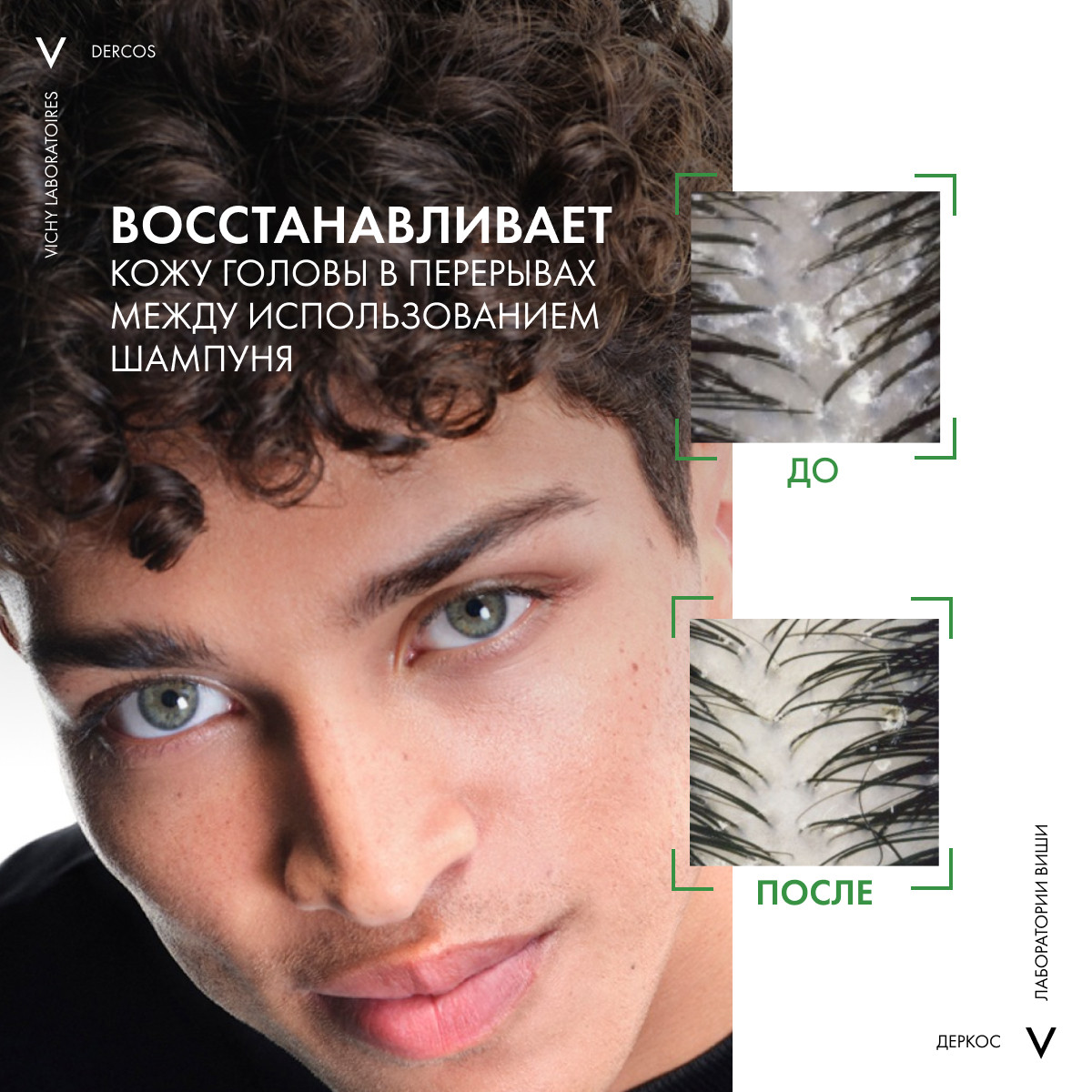 Виши Интенсивная сыворотка от перхоти для волос и кожи головы Anti-Dandruff Serum 10, 90 мл (Vichy, Dercos) фото 7