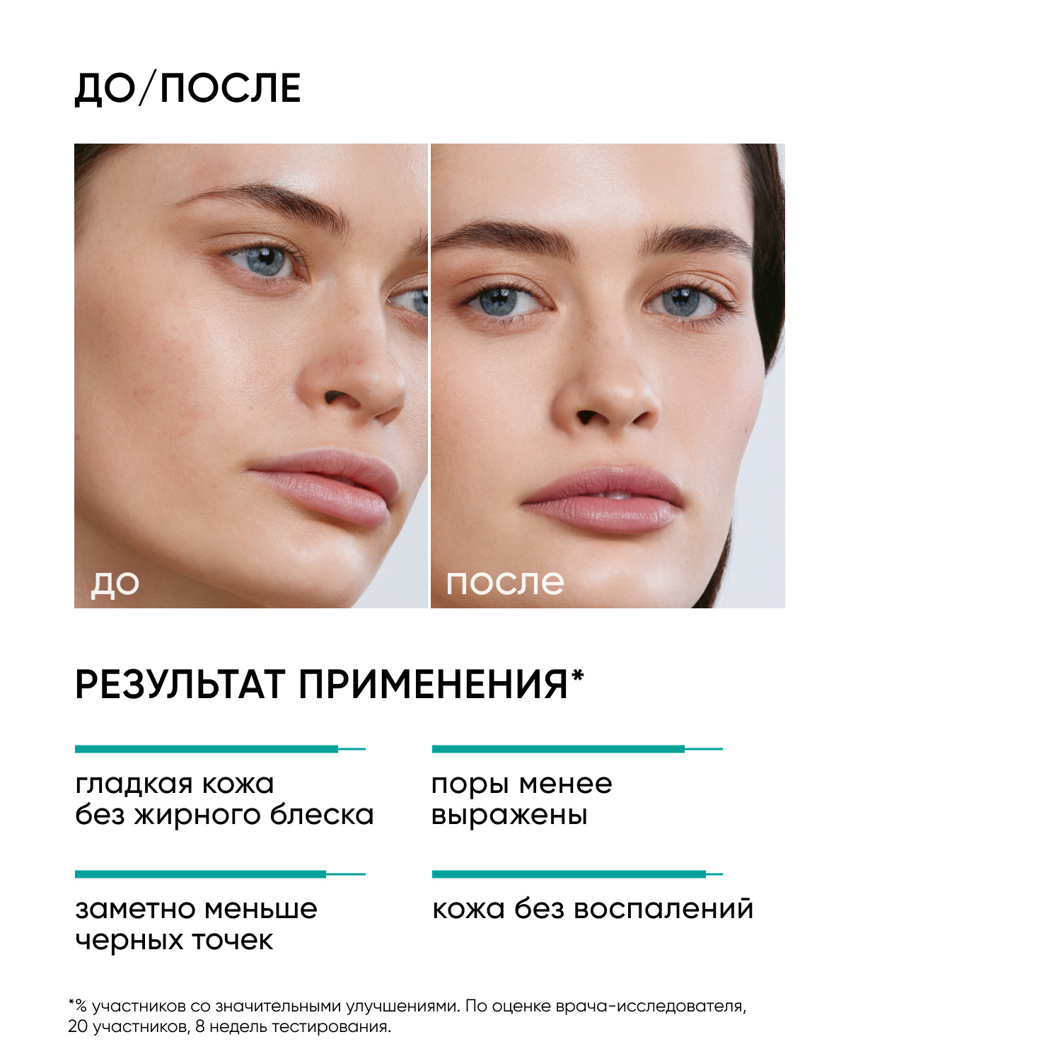 Icon Skin Пилинг AHABHA 15, 30 мл. фото