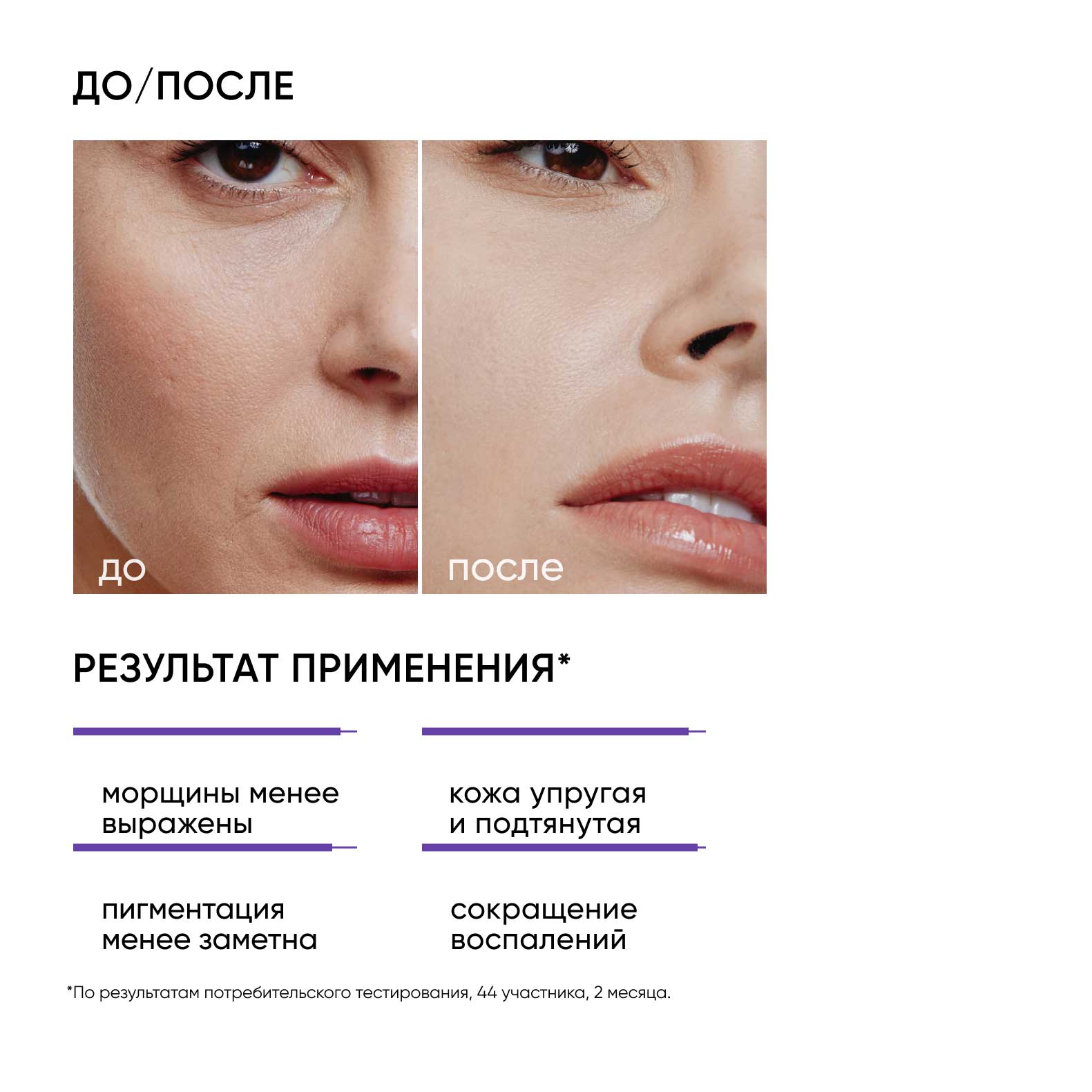 Icon Skin Ночная сыворотка с 0,7 ретинола Advanced Retinol, 30 мл. фото