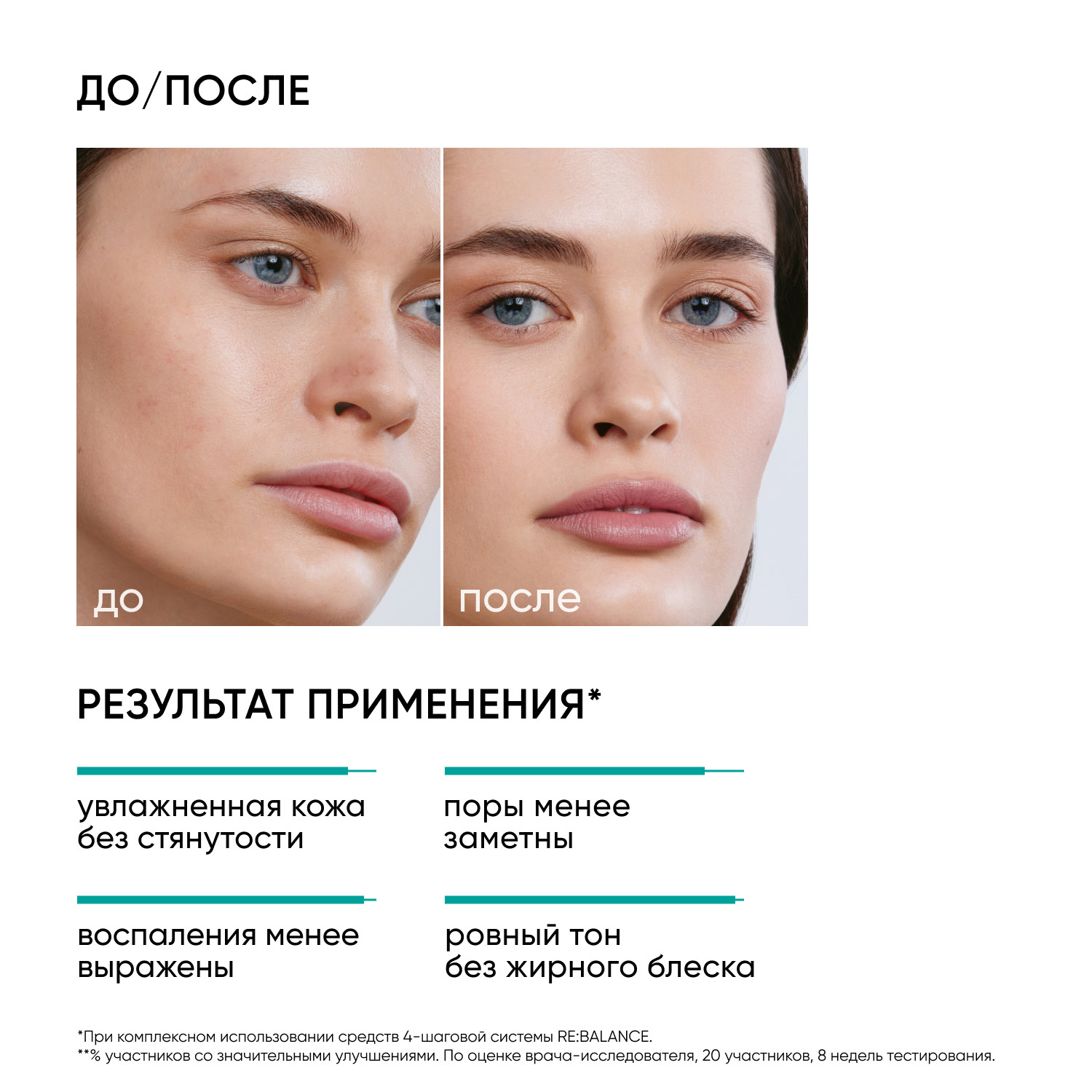 Icon Skin Увлажняющий крем Aqua Essence, 30 мл. фото